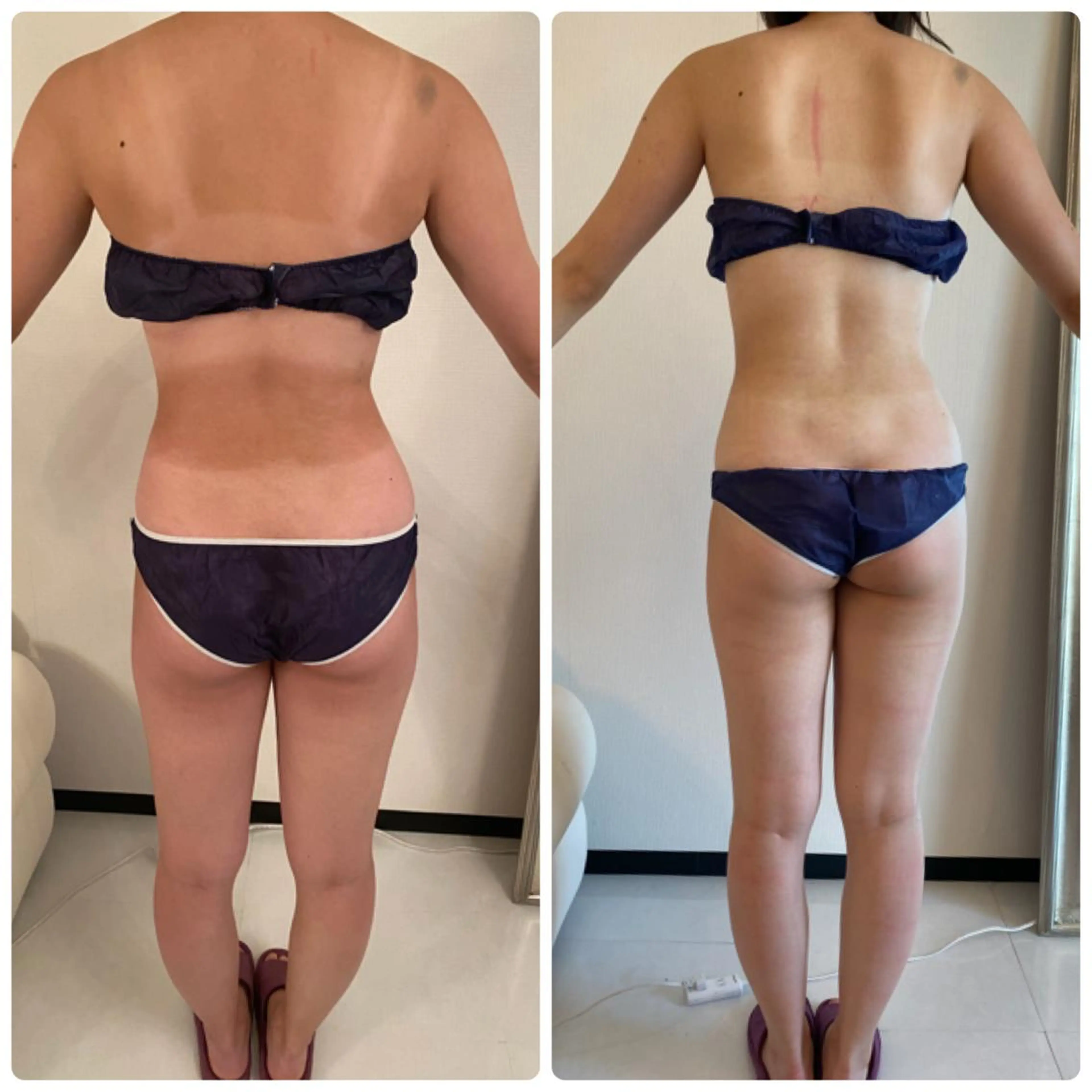 FLEUR大阪・整体 ・ハイフ・痩身・小顔のエステ・リラクイメージ