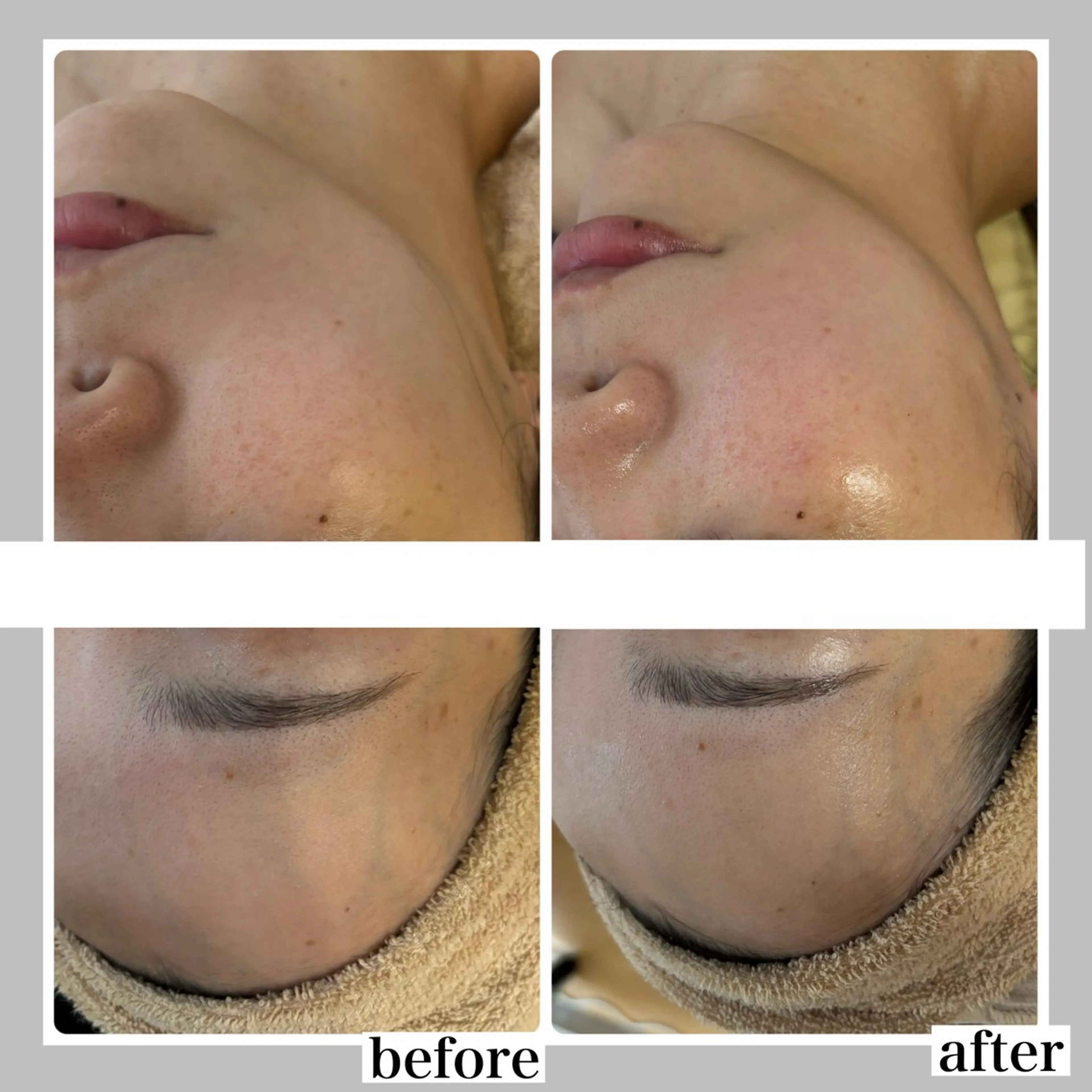 WHITE AQUA 北千住店のエステ・リラクイメージ