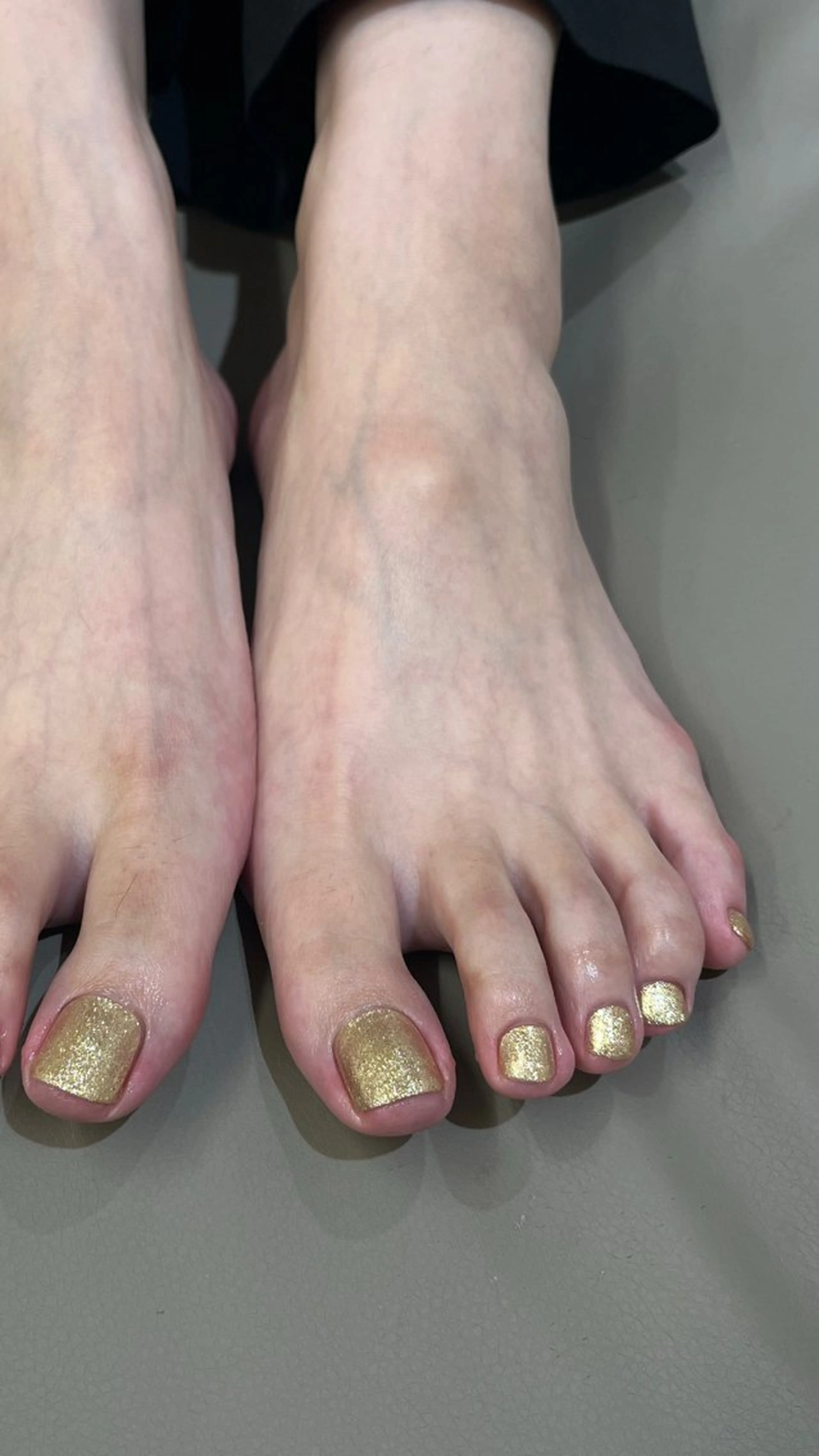 ネイル 甲村 未玖のネイルデザイン