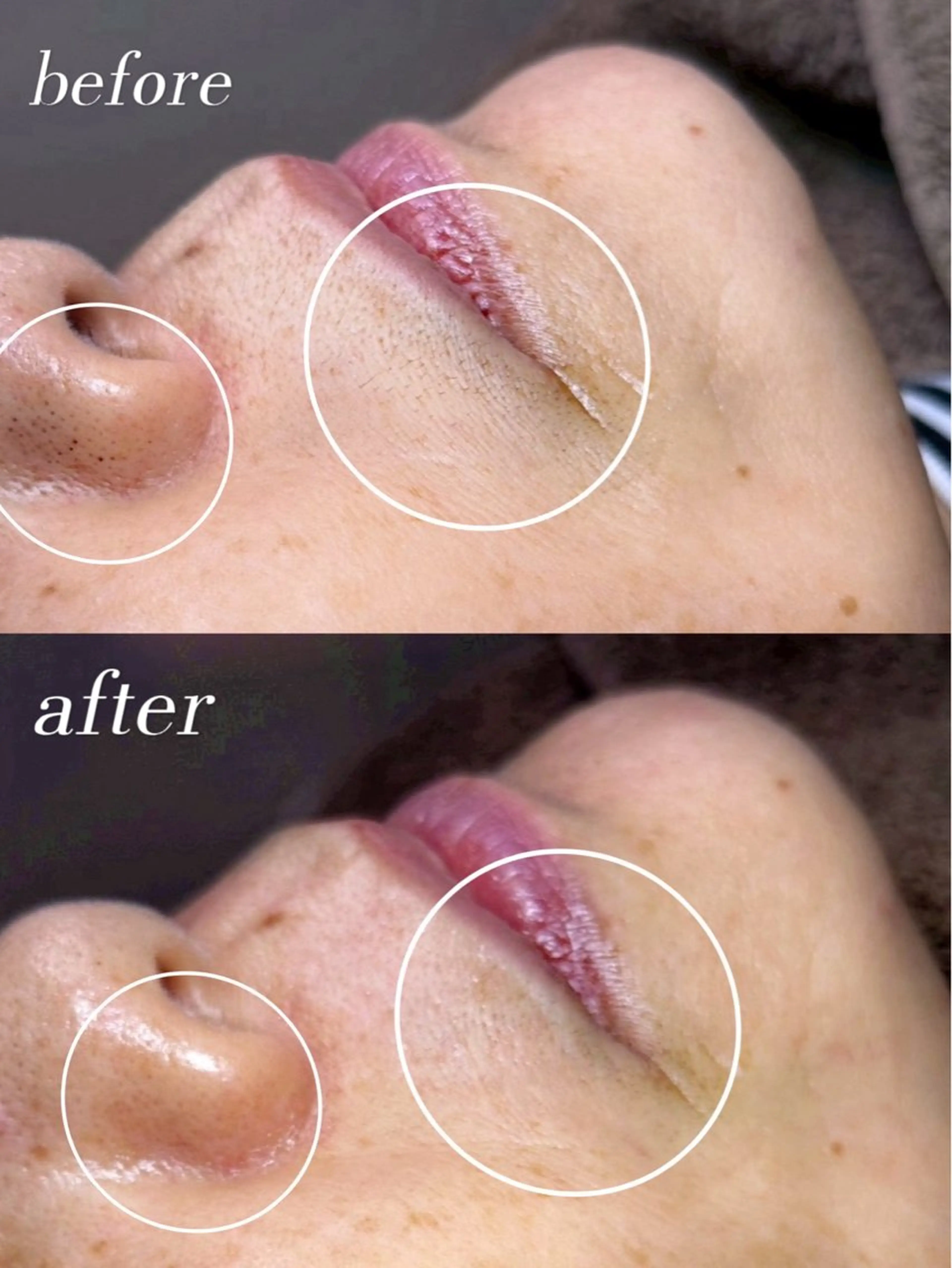 脱毛 長野 美里のエステ・リラクイメージ