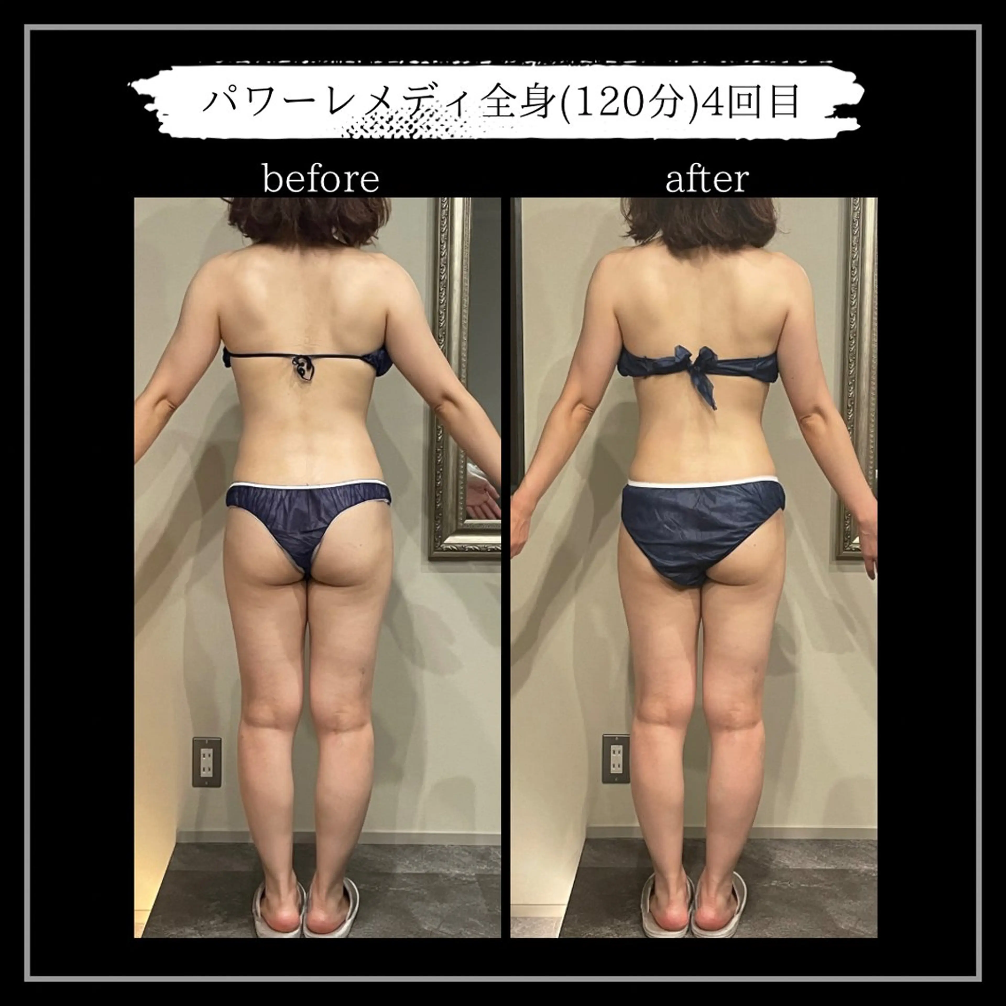 オフ:オン所属・オフ:オン 全身筋膜マッサージのエステ・リラクイメージ