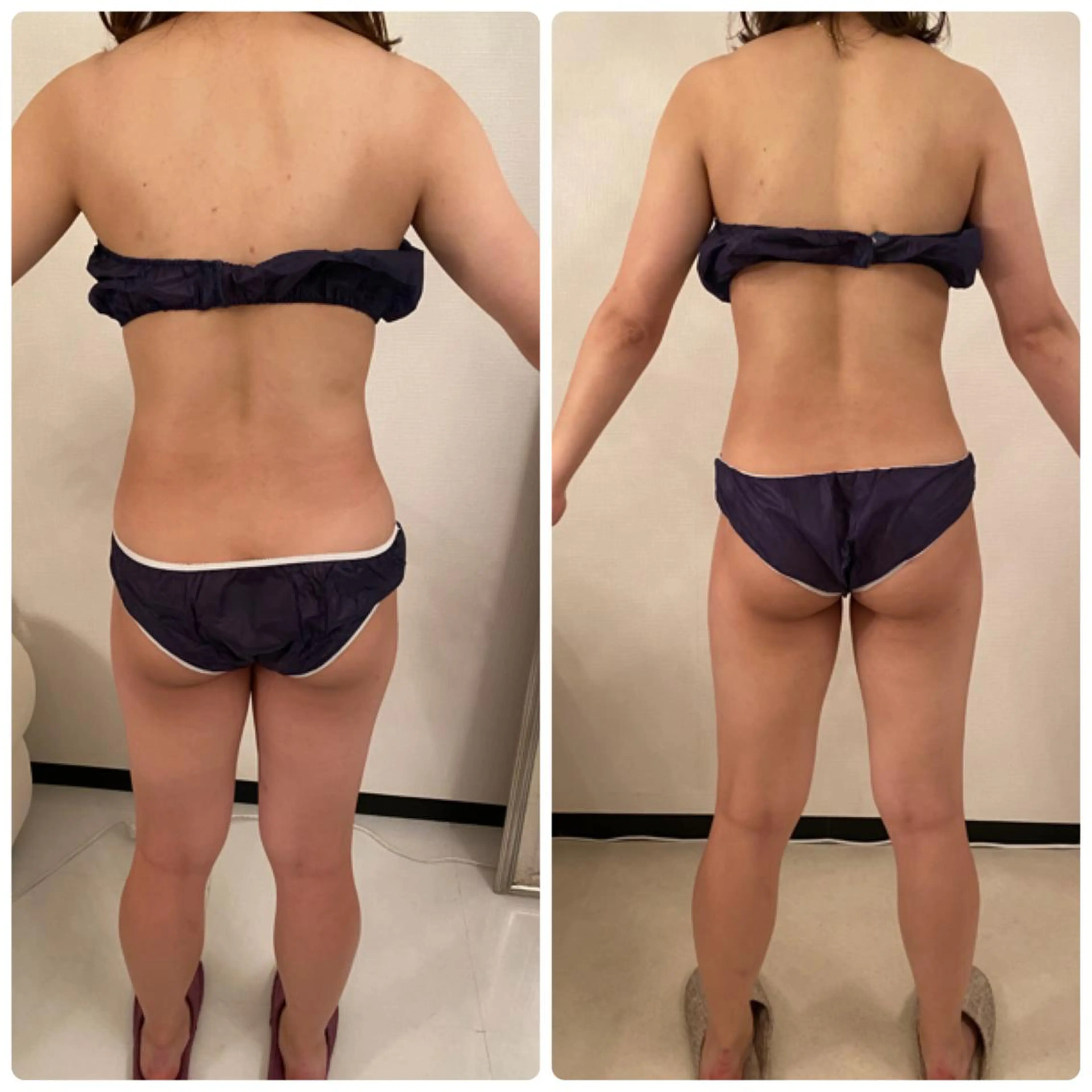 FLEUR大阪・整体 ・ハイフ・痩身・小顔のエステ・リラクイメージ