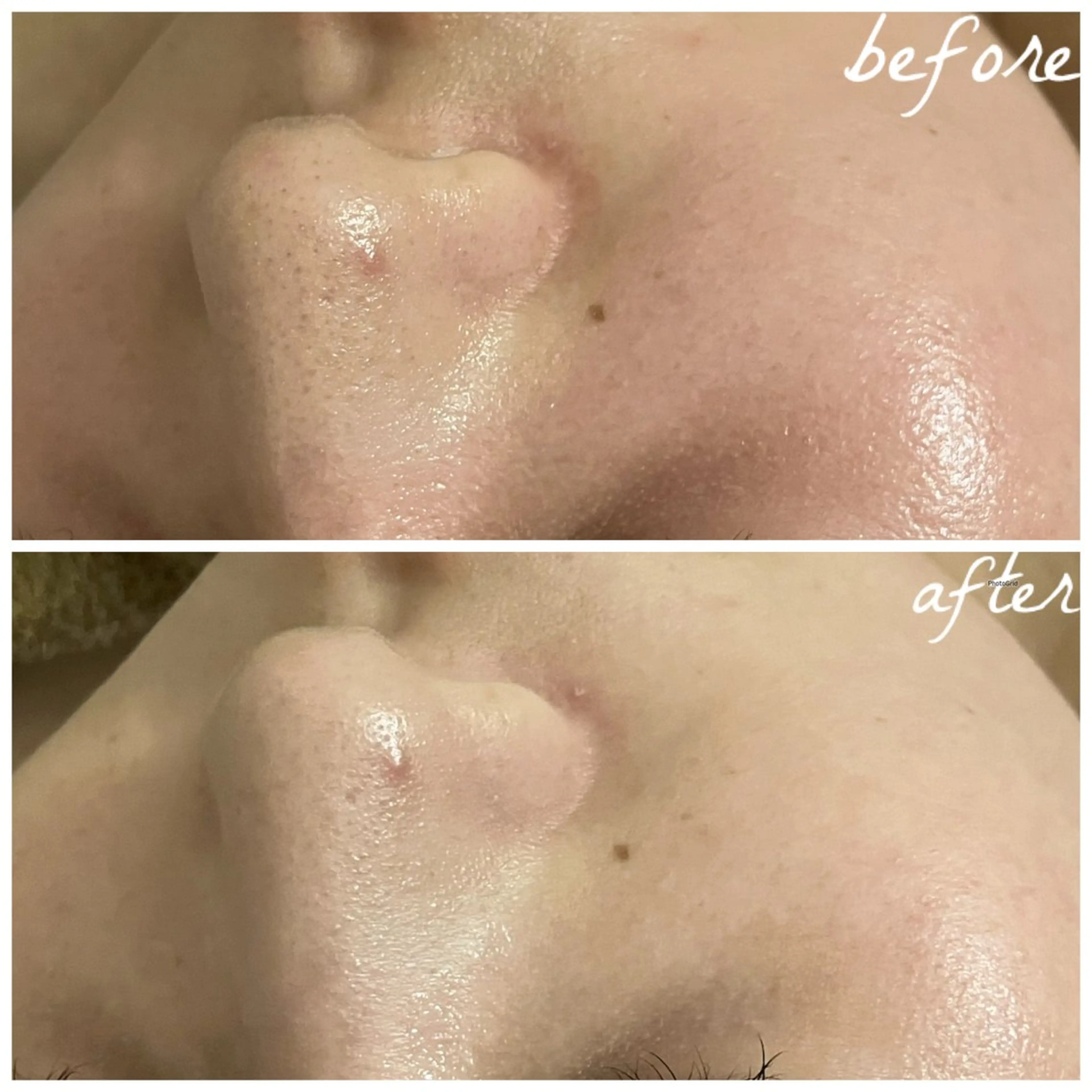 メンズ エステ メナード岐阜茜部 杉浦のエステ・リラクイメージ