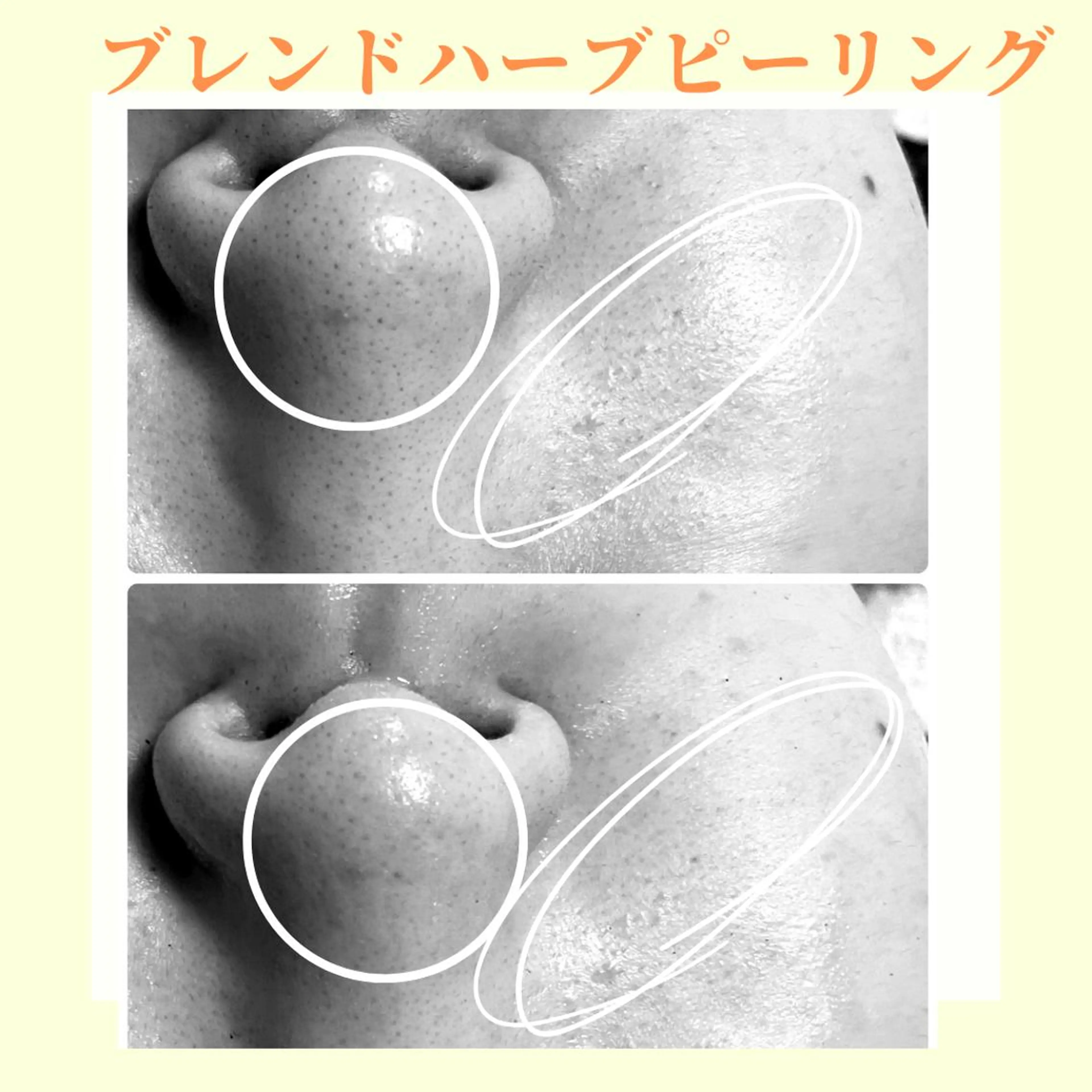 エステ リラク ピーリング専門店 Belluteのエステ・リラクイメージ
