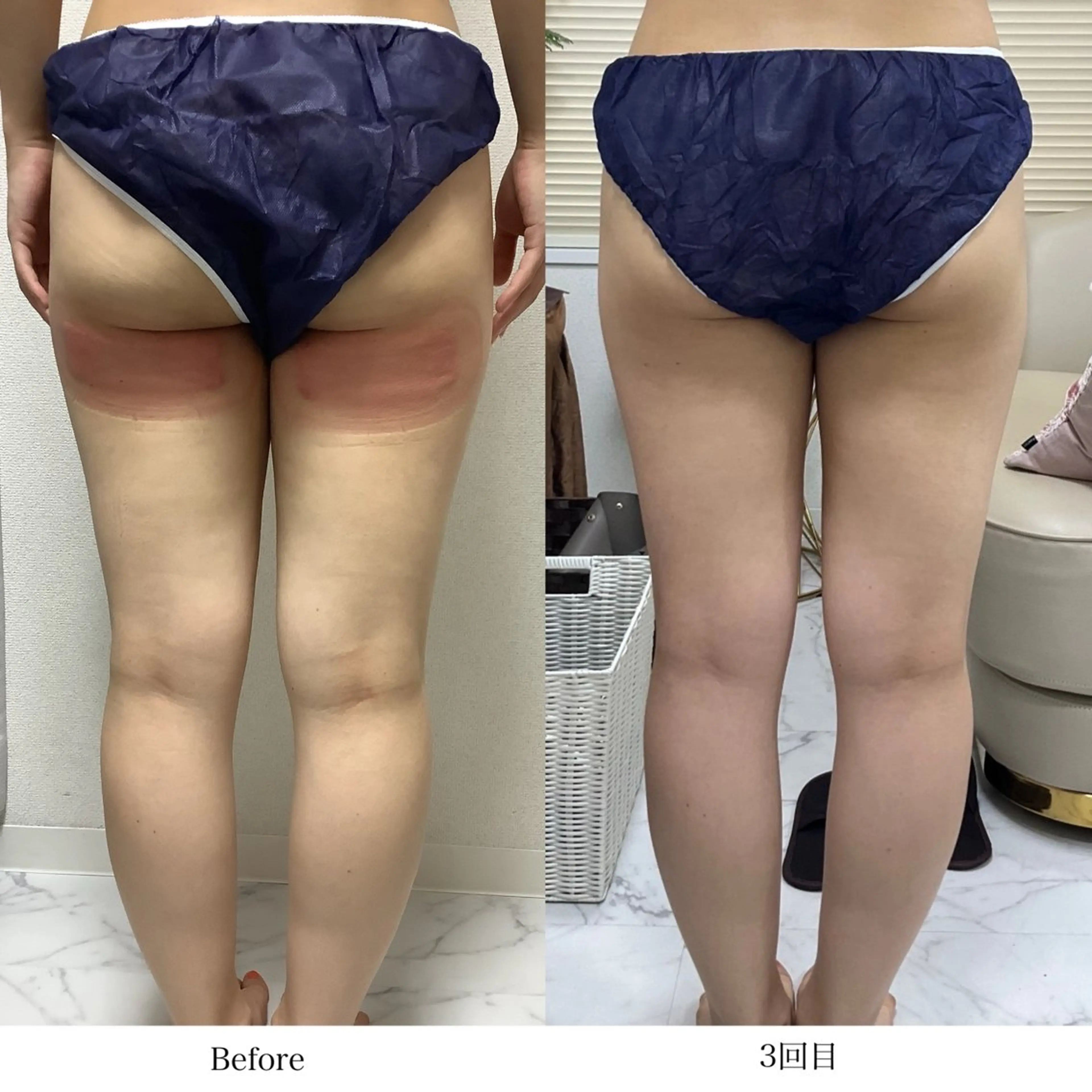 冷却専門店 SLARIのエステ・リラクイメージ