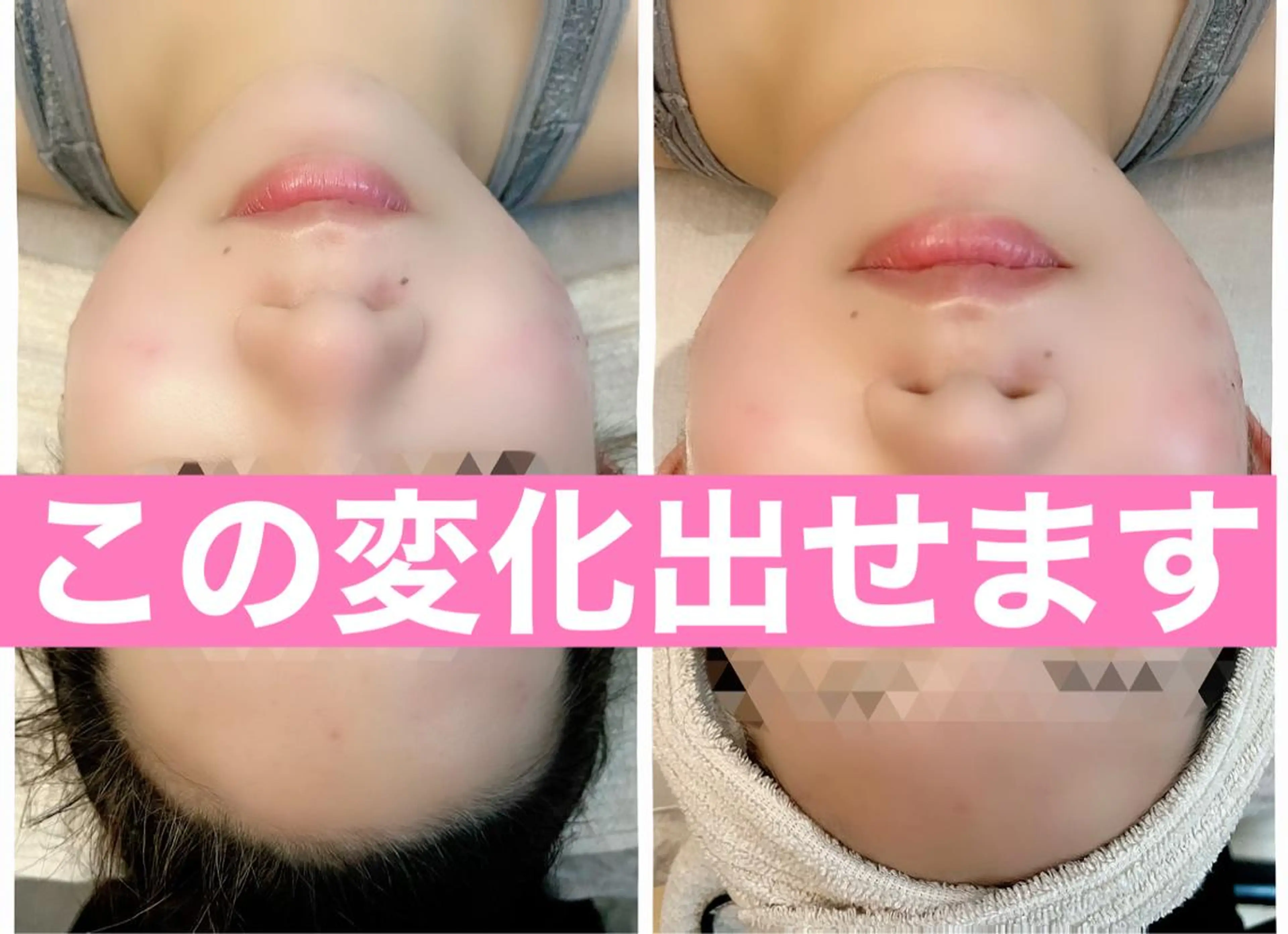 ■超絶小顔＆肌管理室■所属・🦋整形級の究極美顔 本格韓国式小顔🦋のエステ・リラクイメージ