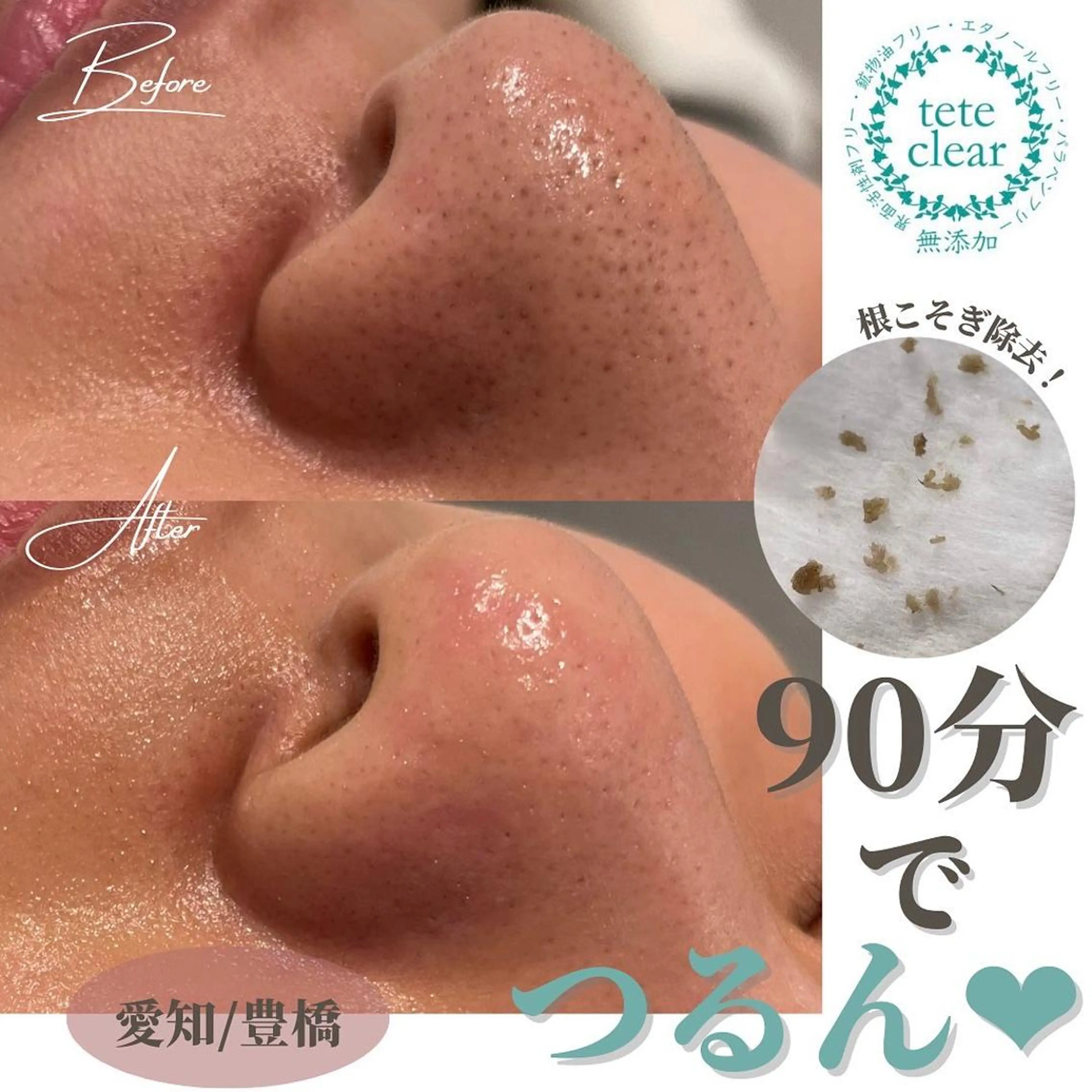 エクストラクション後の毛穴をきれいにキープしてくれる