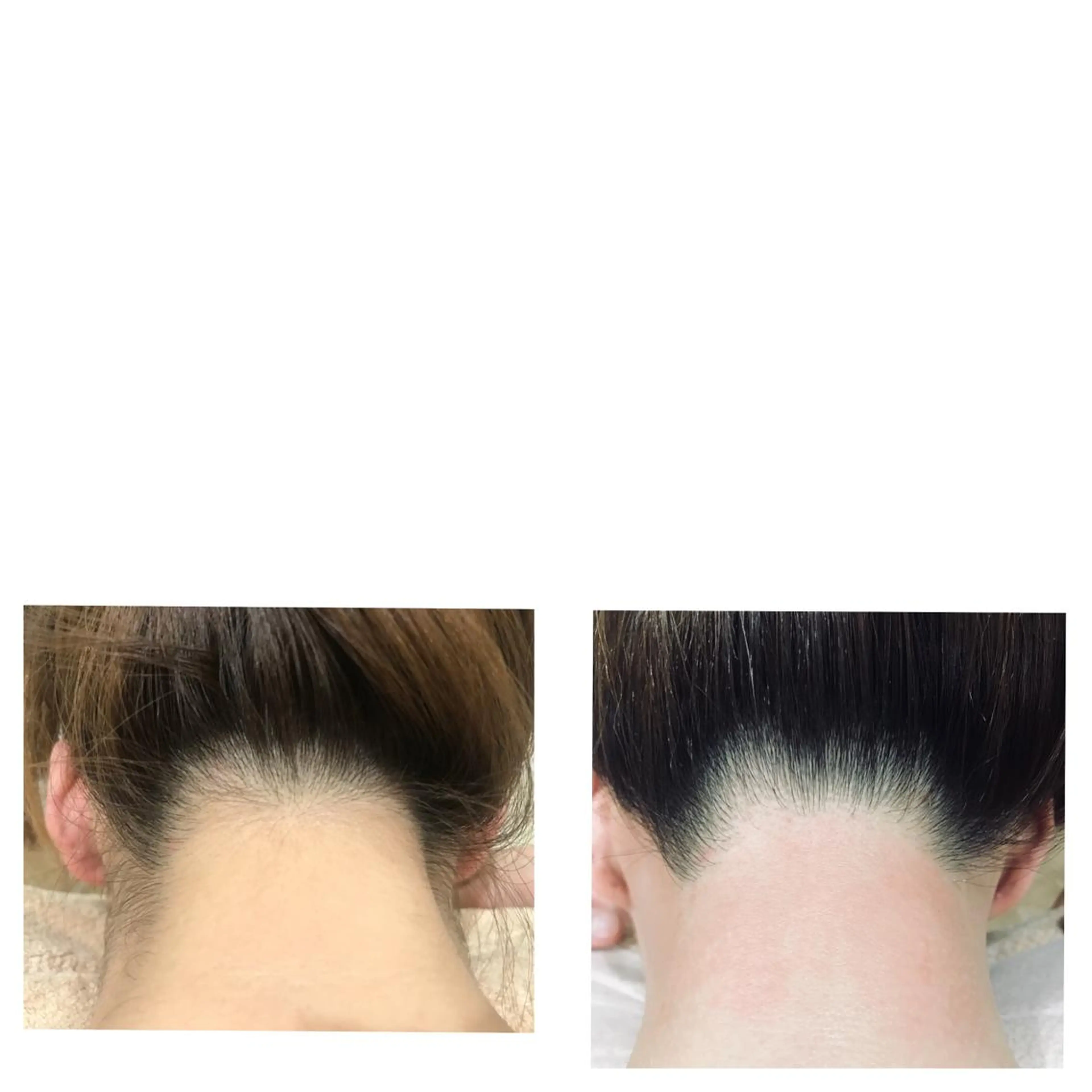 フェイシャル/脱毛 ジョアアンジェ　田中のエステ・リラクイメージ