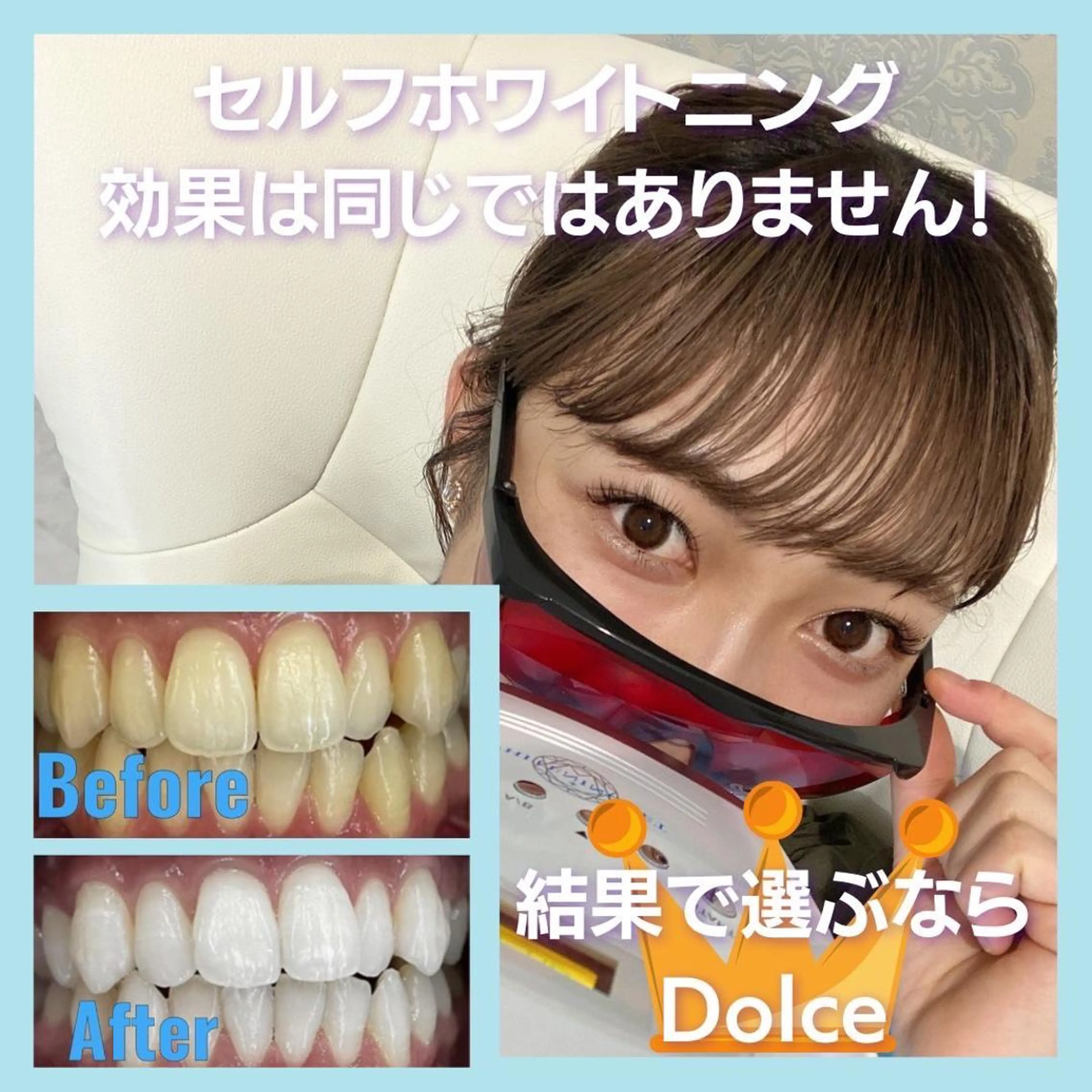 その他 セルフホワイトニング Dolce八王子店のその他イメージ