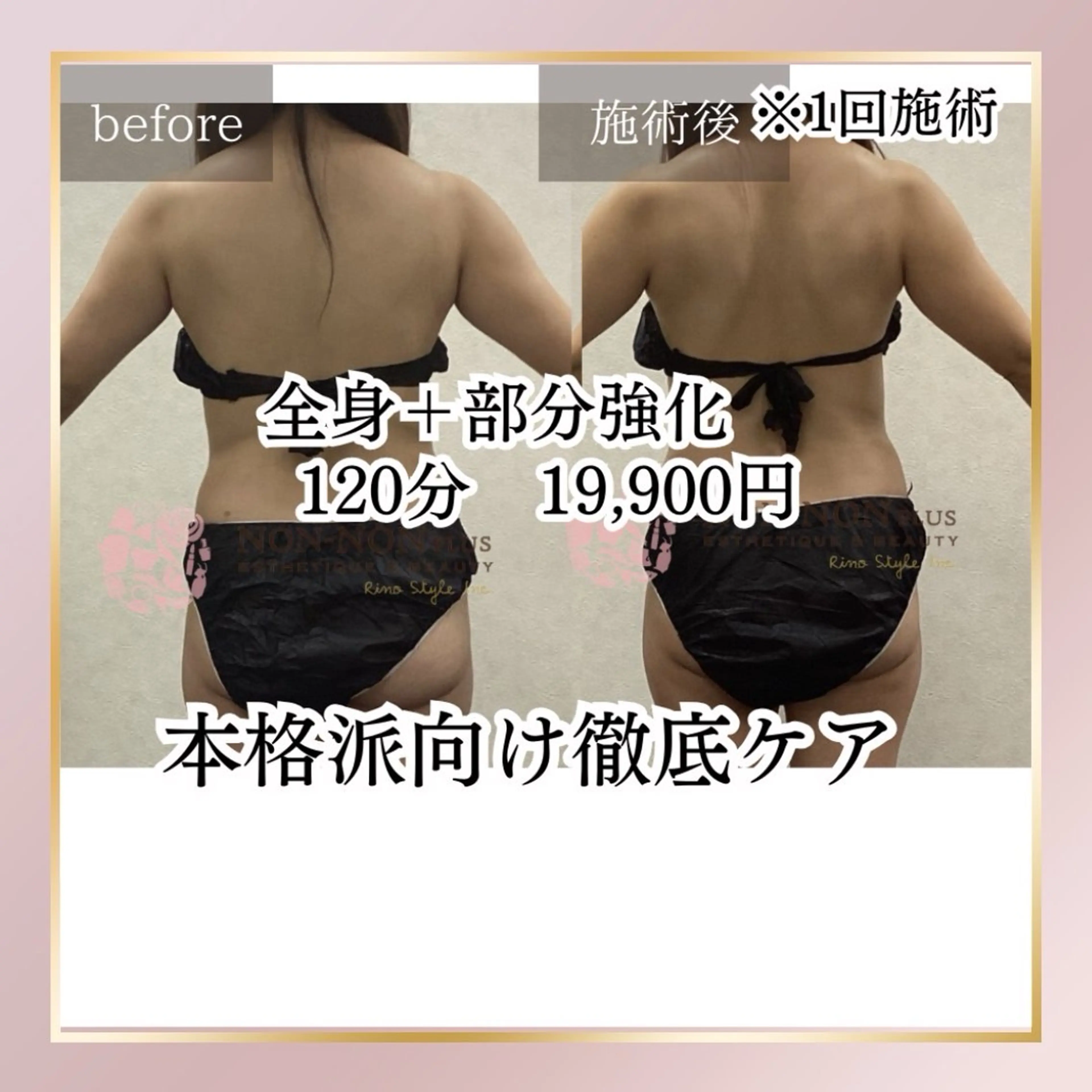 【１回でも結果出る！】ミニモプレミアム全身美ボディ➕部分強化1200分１回24900円→初回19900円！の写真
