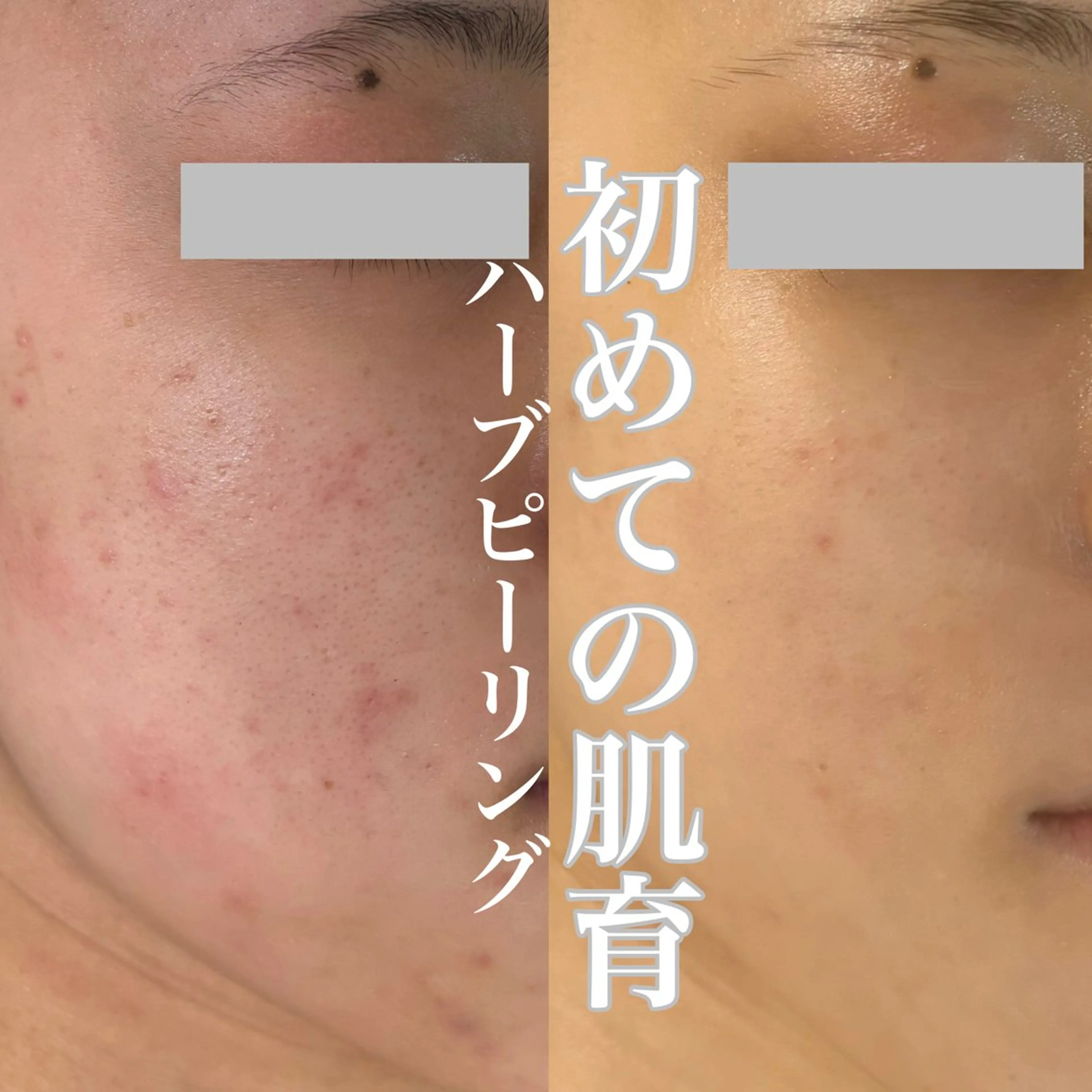 エステ WHITE AQUA 北千住店のエステ・リラクイメージ