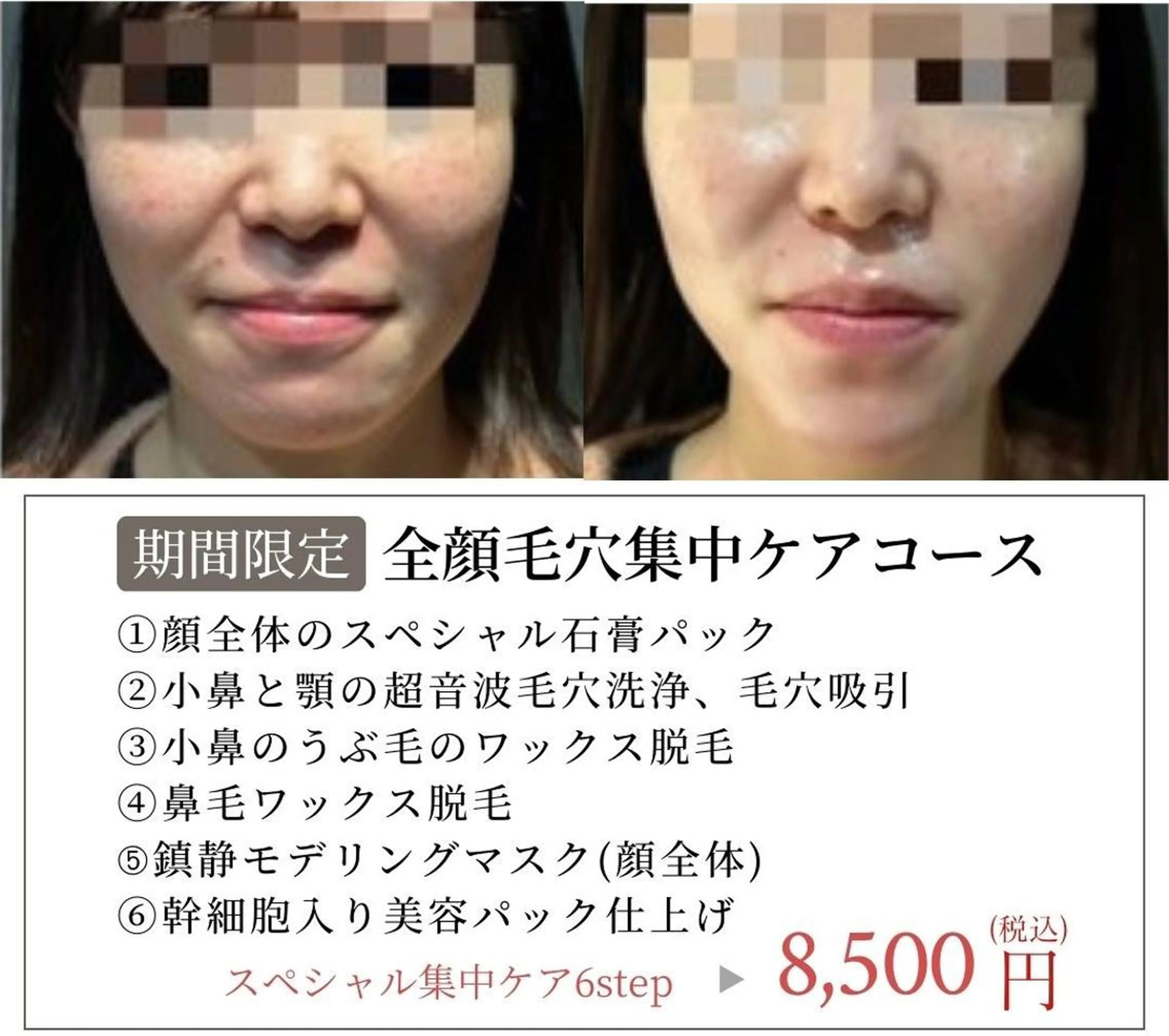 エステ Maple 【美容サロン】の眉毛・アイブロウイメージ