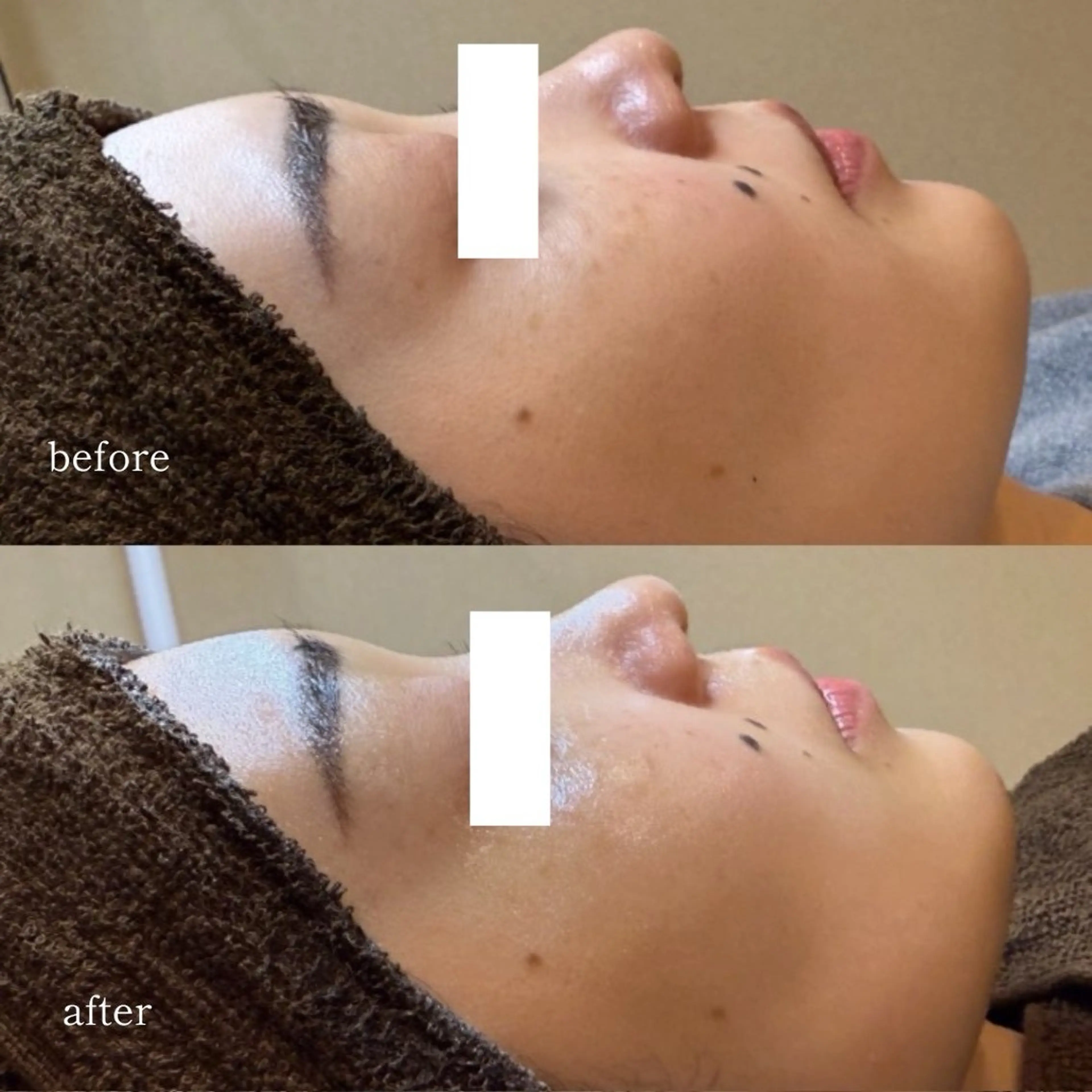 エステ EARNEST大阪 心斎橋【韓国肌管理】のエステ・リラクイメージ