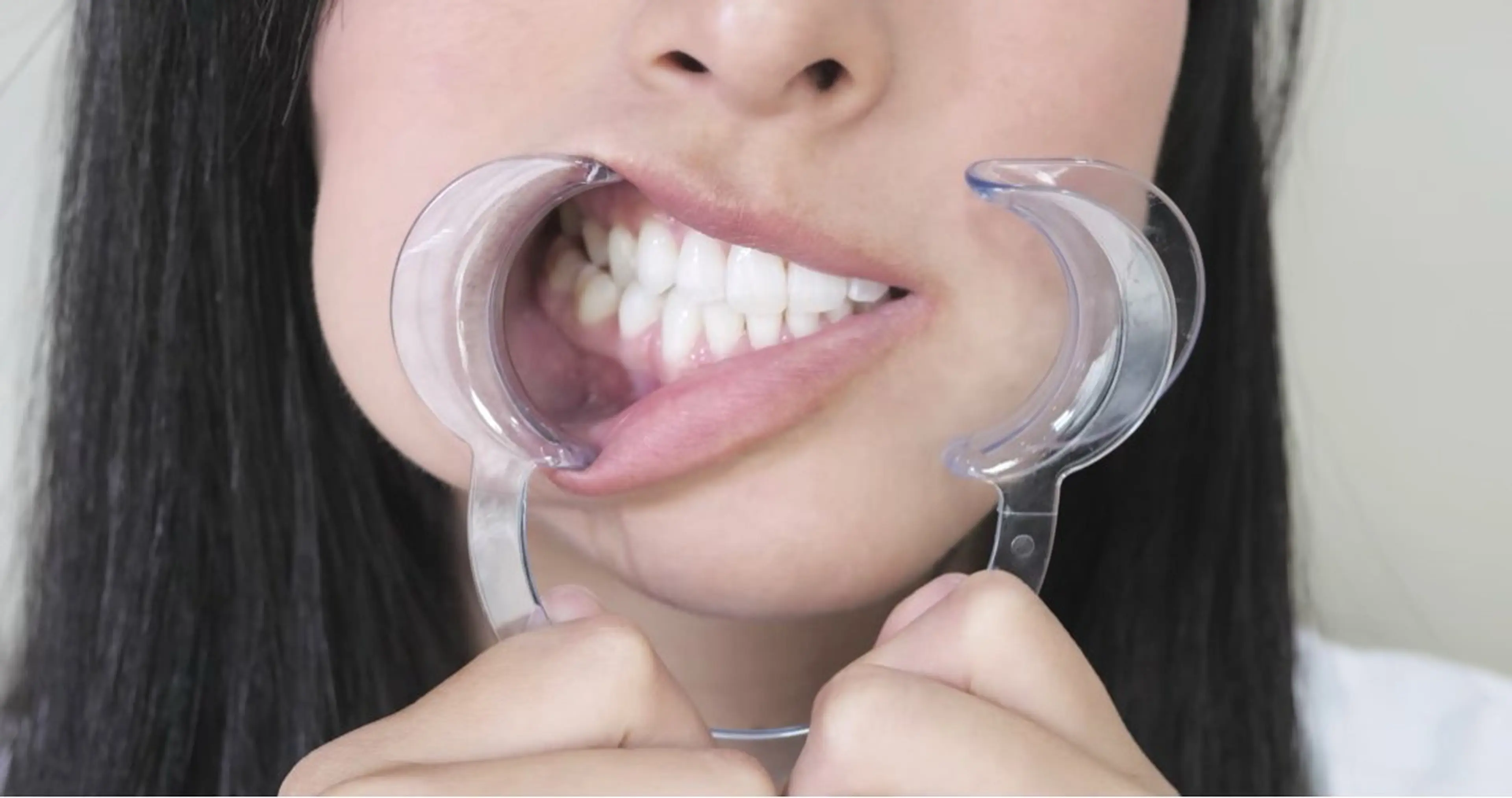 【❗️当日限定❗️】歯の黄ばみにセルフホワイトニング体験メニュー🦷✨8分×3回で効果実感👏セルフで簡単本格ケア💎の写真