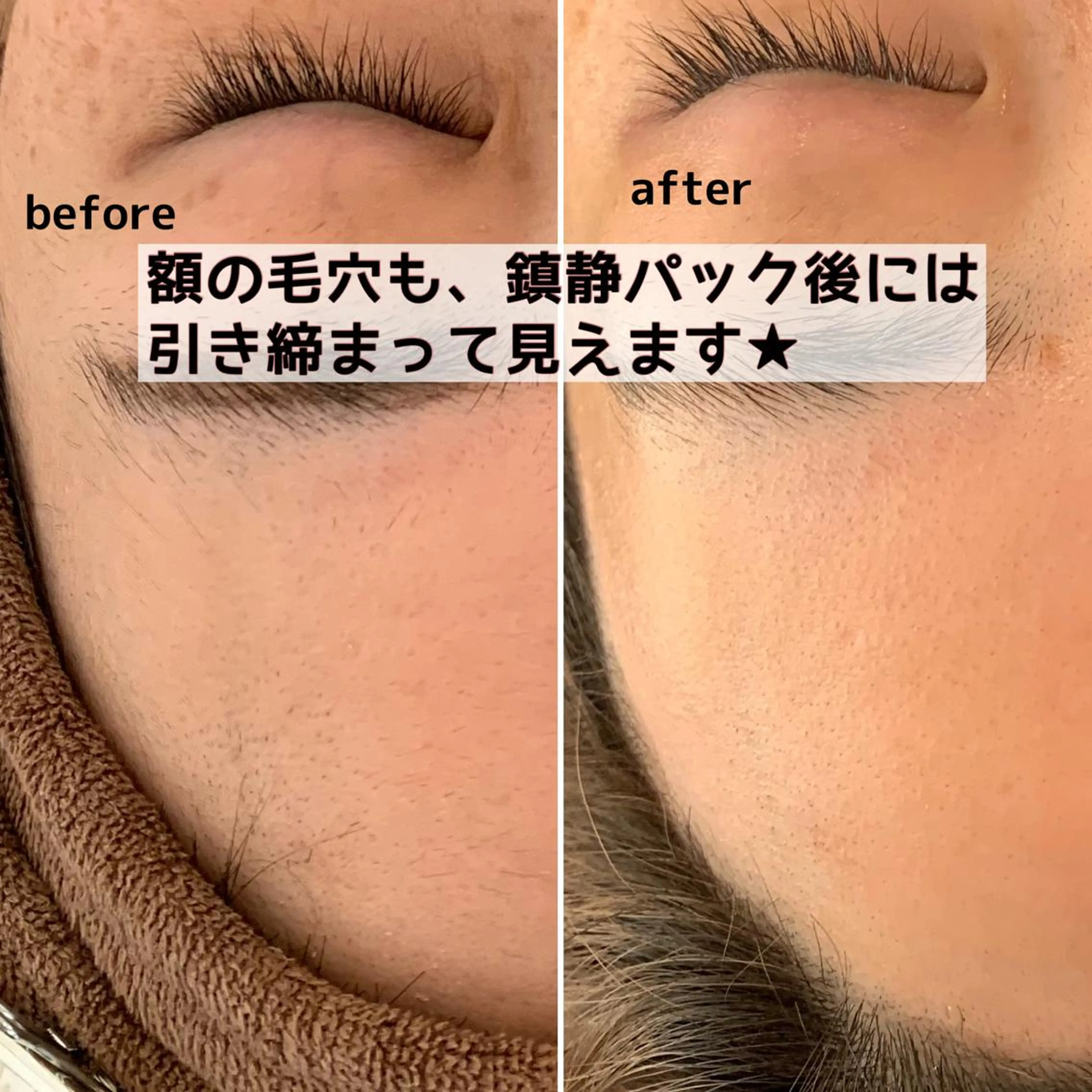 美肌コラーゲン脱毛SINCERITE【サンセリテ】所属・瀬野 のぞみのエステ・リラクイメージ