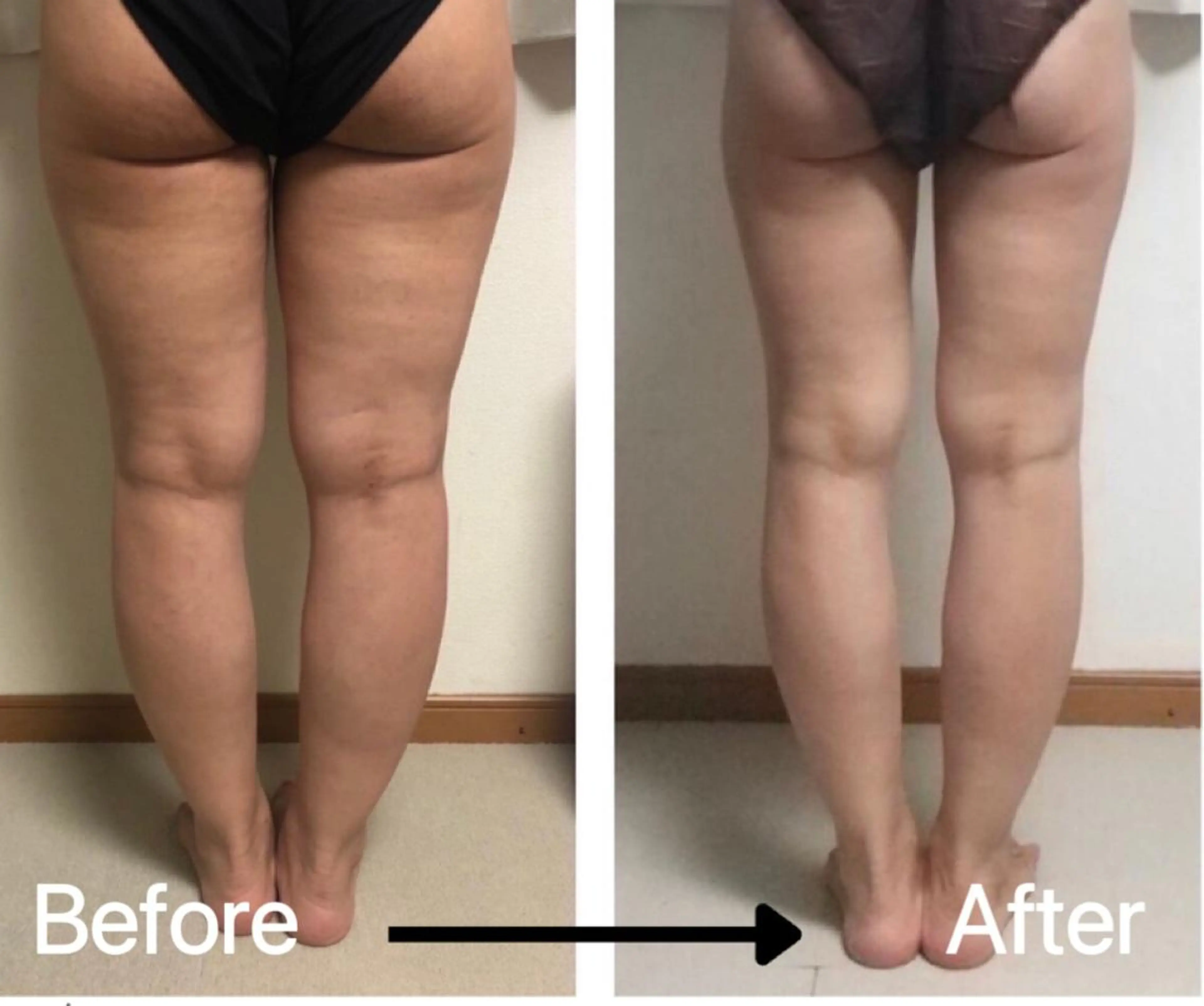 小顔痩身インディバ Nana表参道のエステ・リラクイメージ