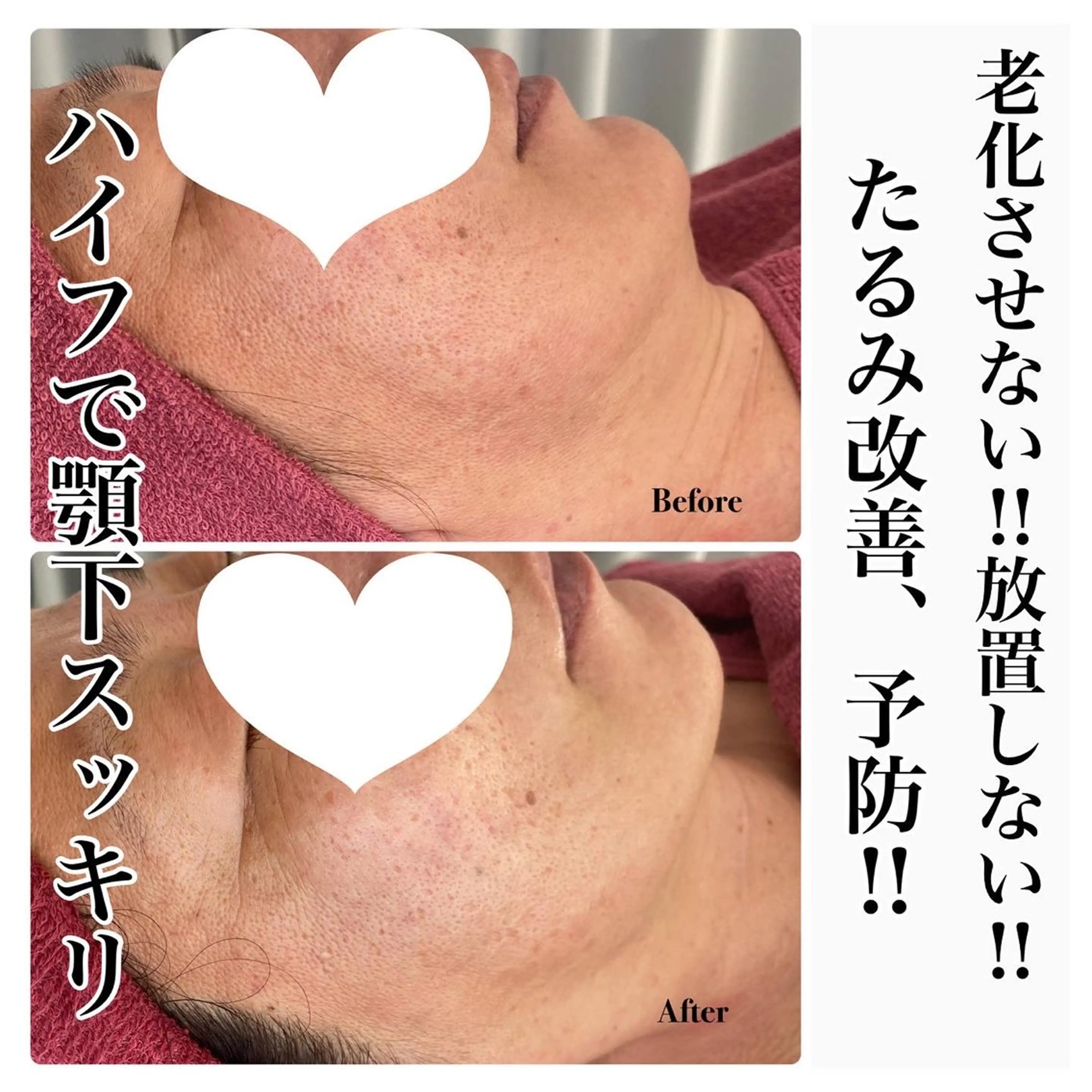 エステ Chalon所属・REVI取扱・肌悩み 改善　Chalonのエステ・リラクイメージ