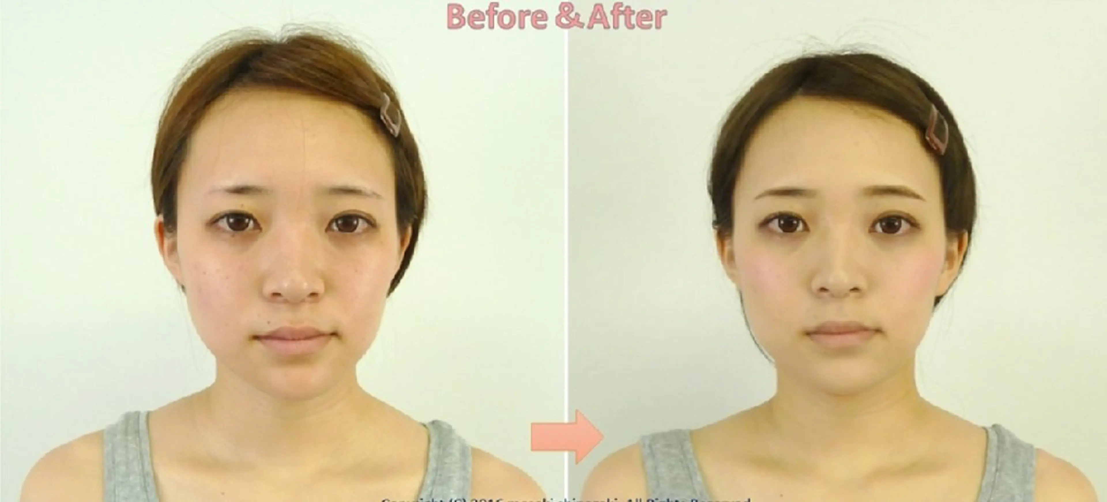 美容整サロン DOLCE のエステ・リラクイメージ