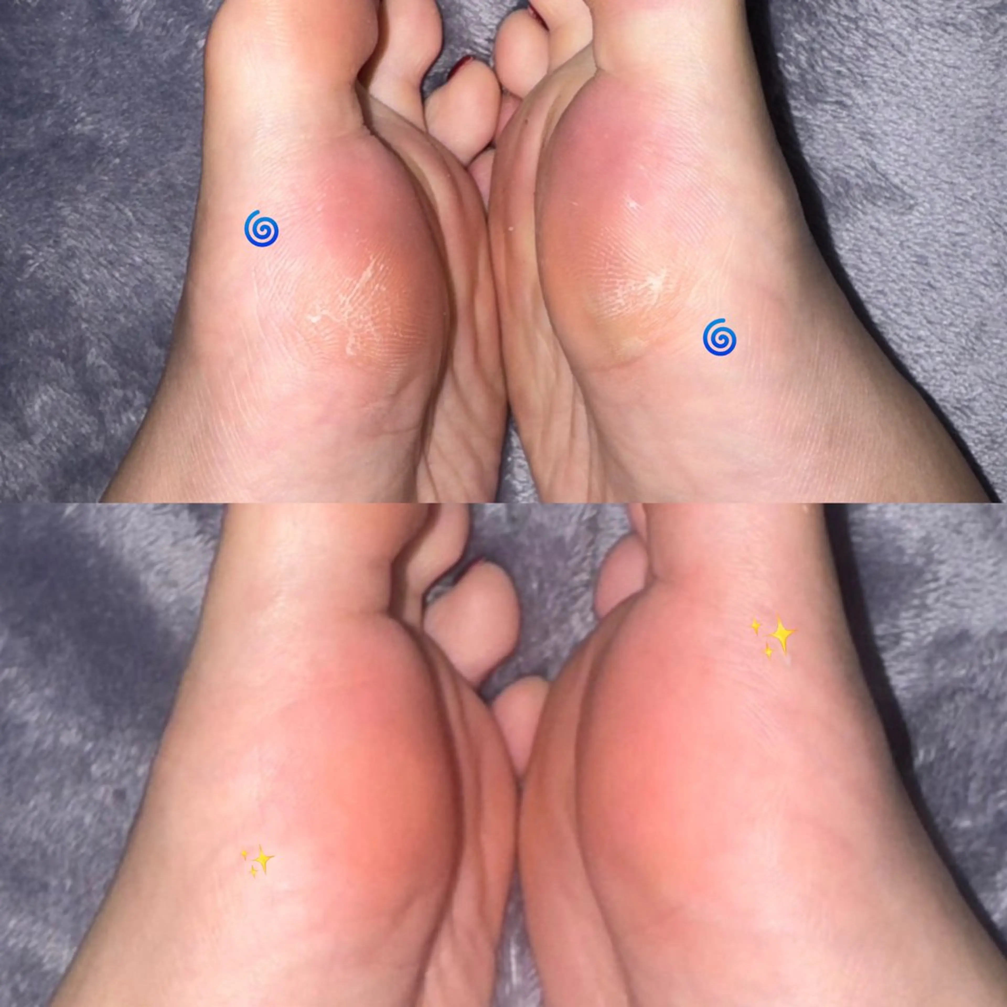 角質ケア👣✨の写真