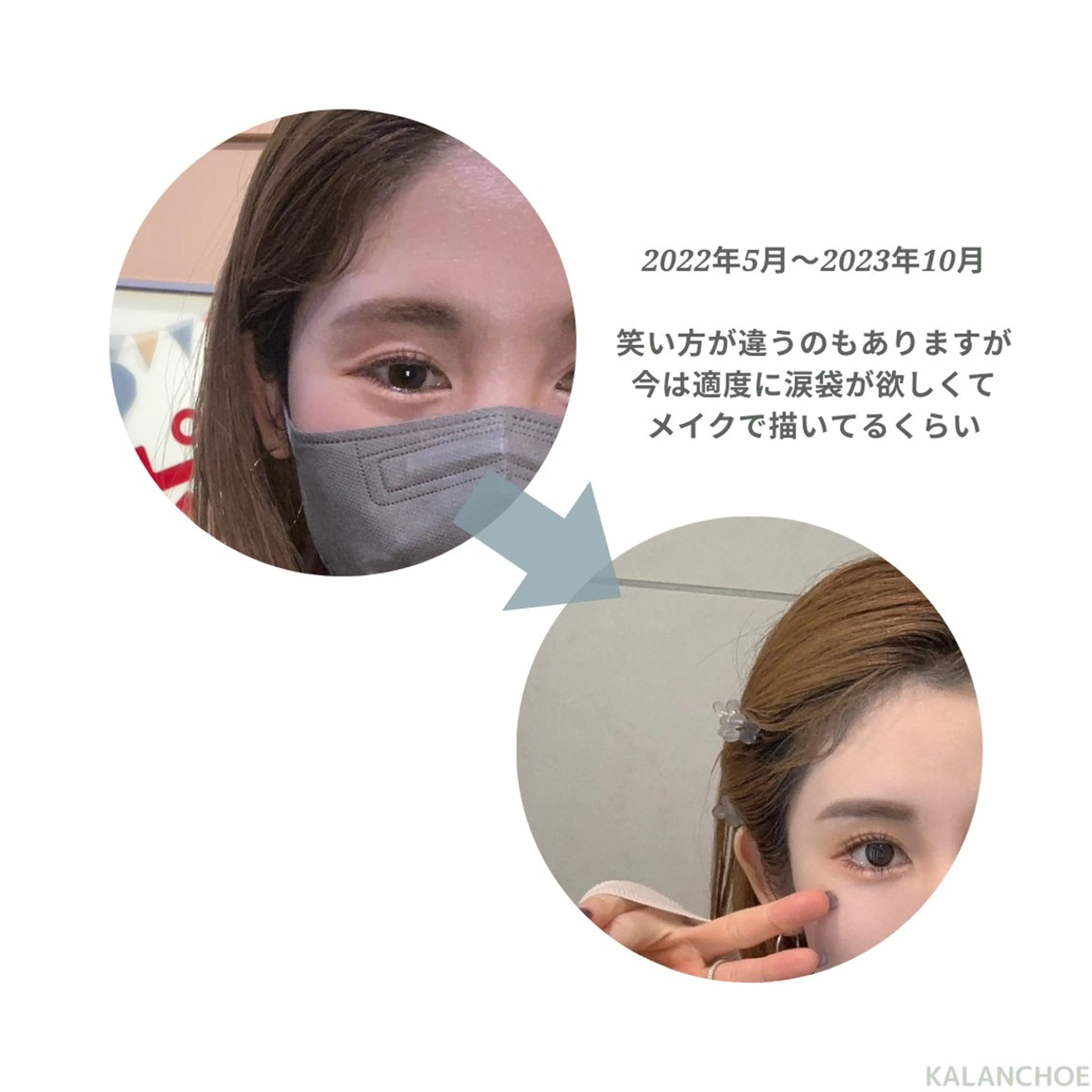 エステ 肌質改善 KALANCHOEのエステ・リラクイメージ