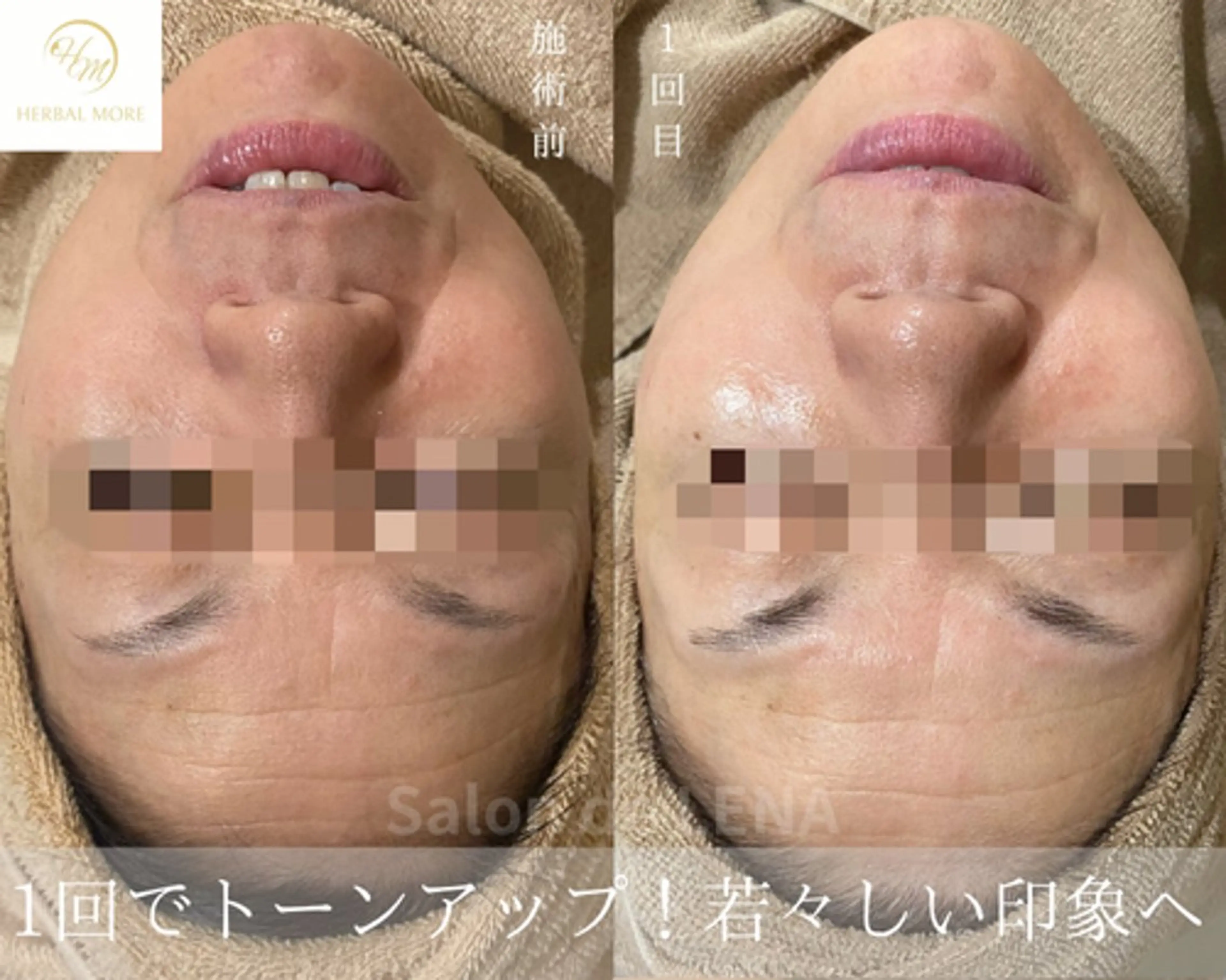 ハーブピーリング・毛穴ケア専門サロンSalon de LENA 栄店所属・ハーブピーリング専門 サロンドレナ　白藤のエステ・リラクイメージ