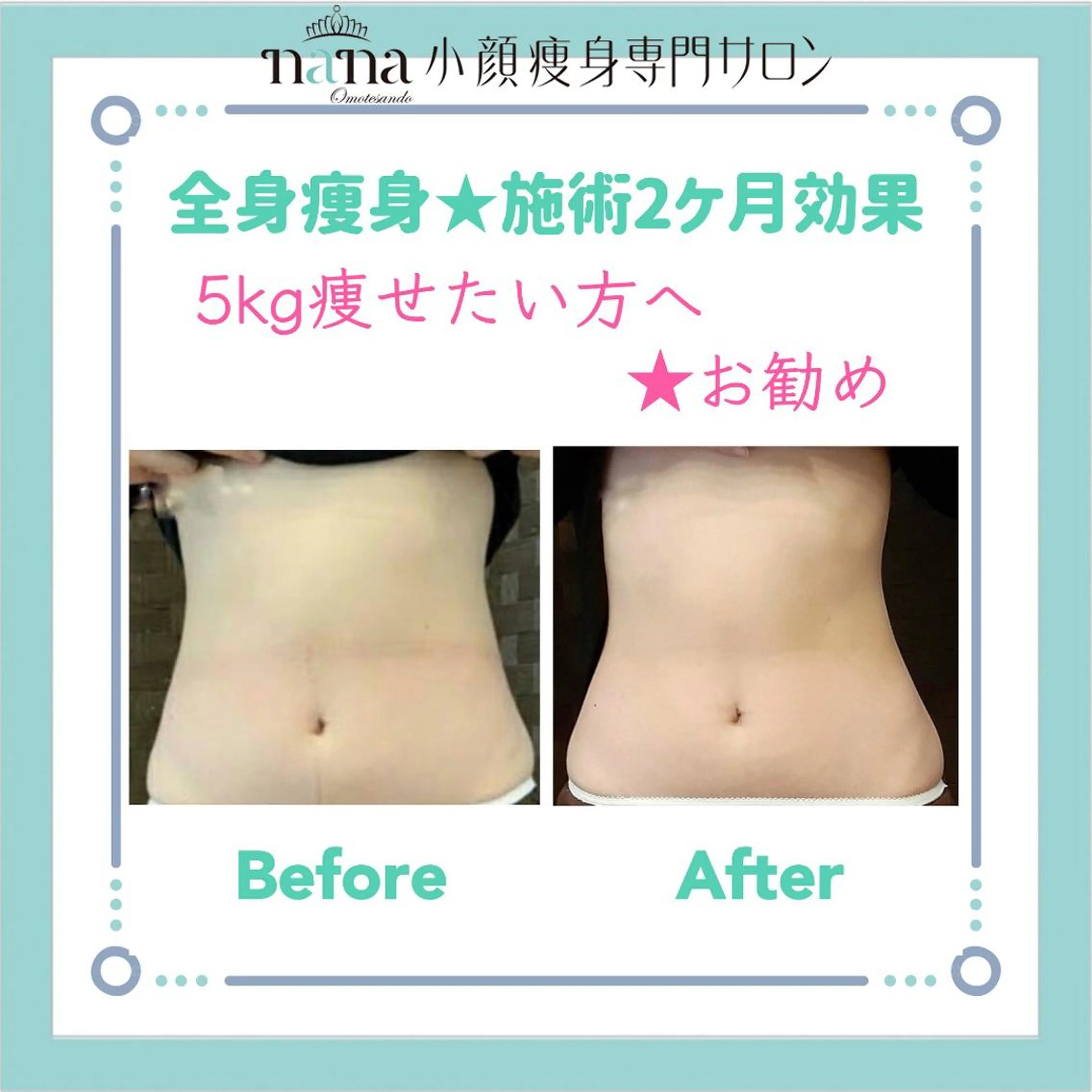 小顔痩身インディバ Nana表参道のエステ・リラクイメージ