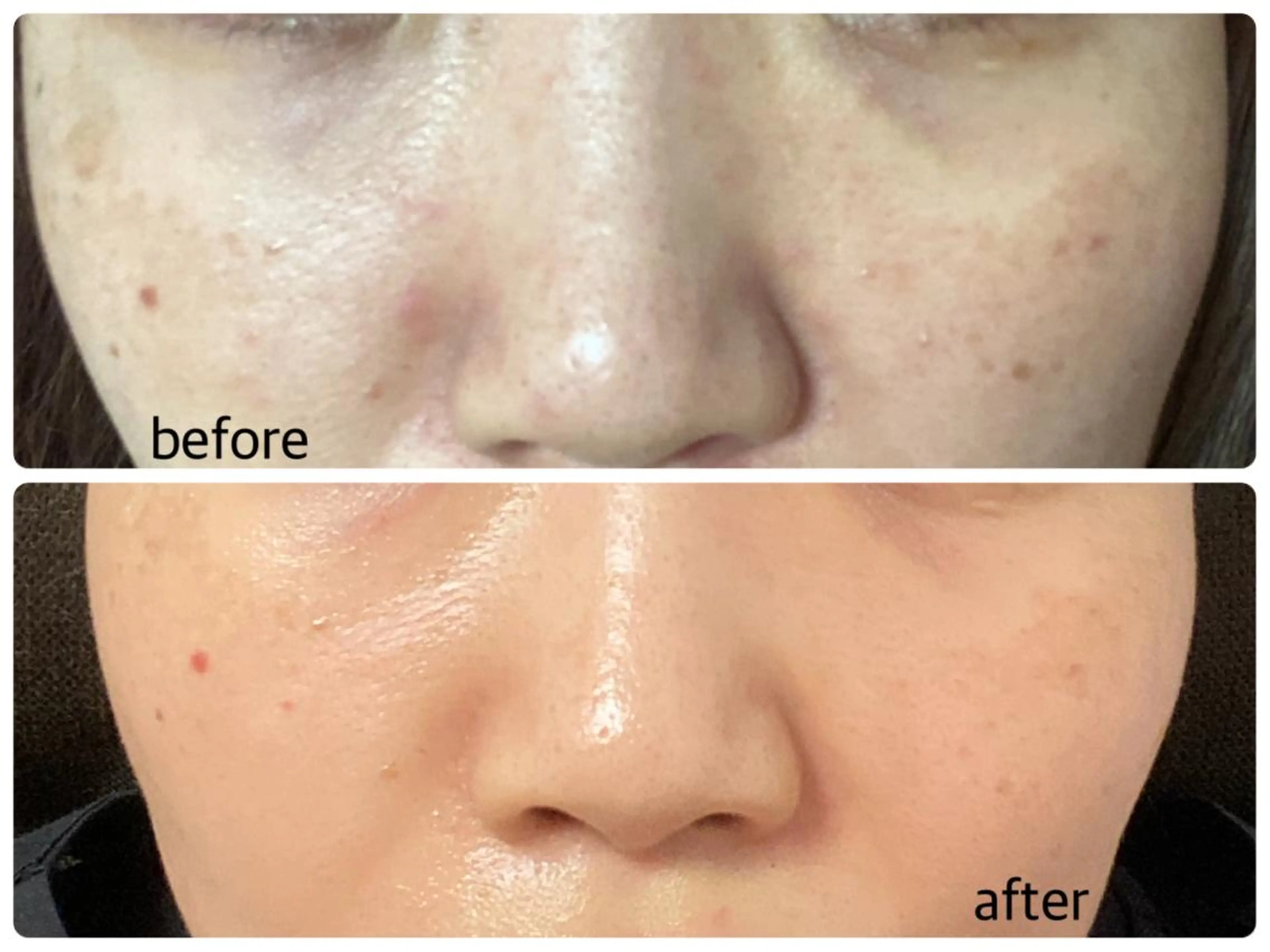 エステ エル美容室所属・oshima yuukiのマツエク・マツパデザイン