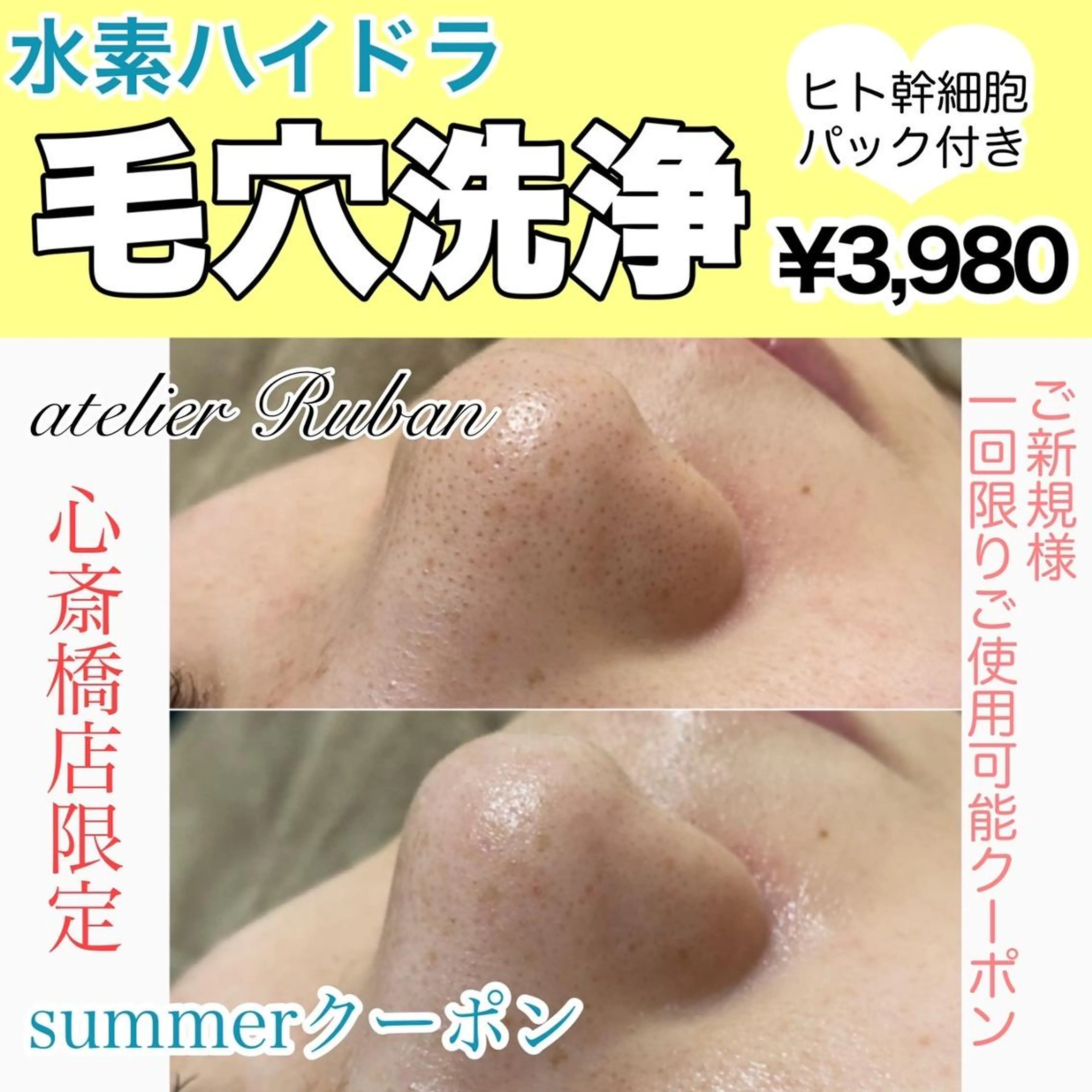 ✨美肌水光✨ アトリエリュバンのエステ・リラクイメージ