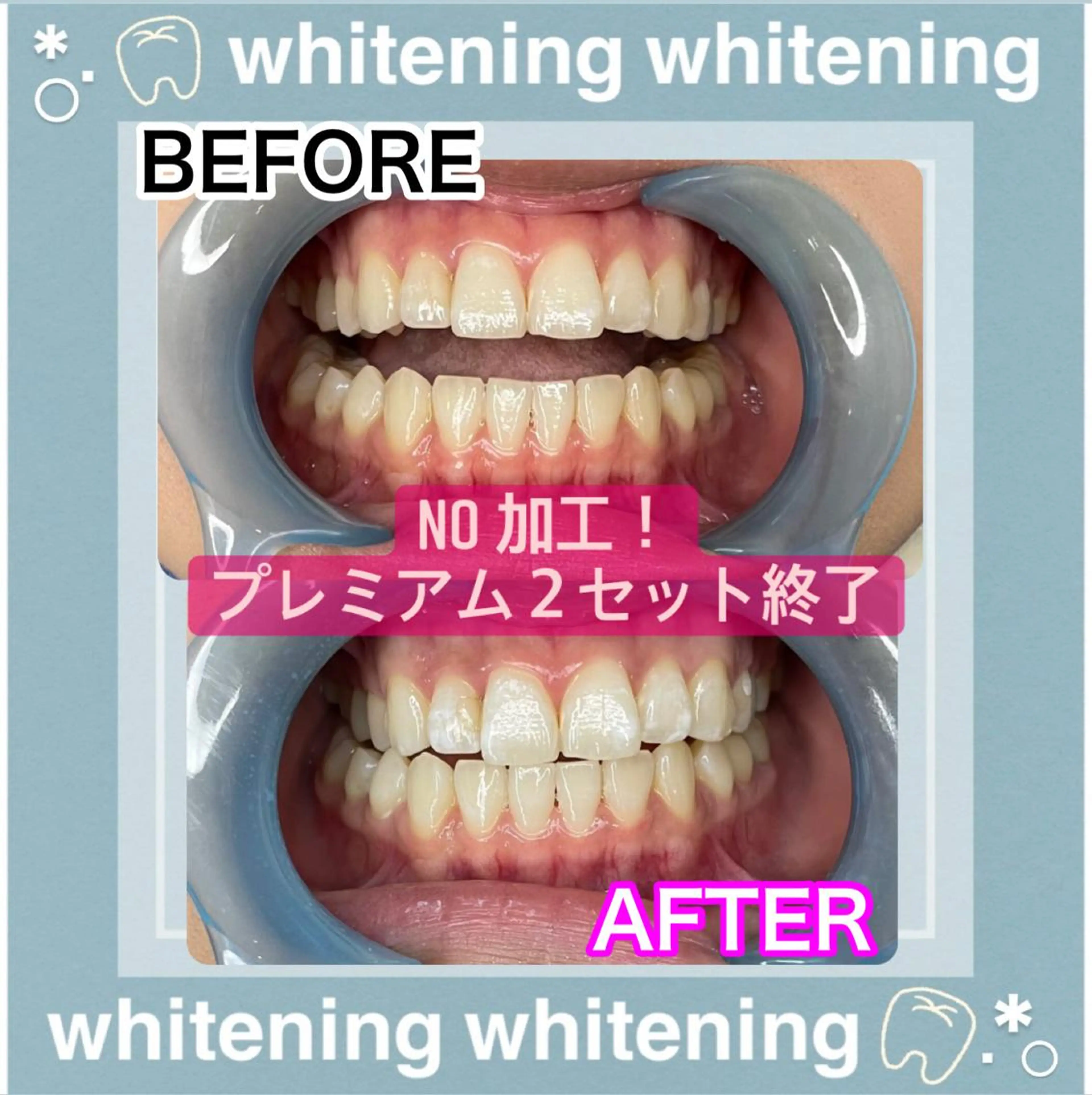 LAVISH nail salonのネイルデザイン