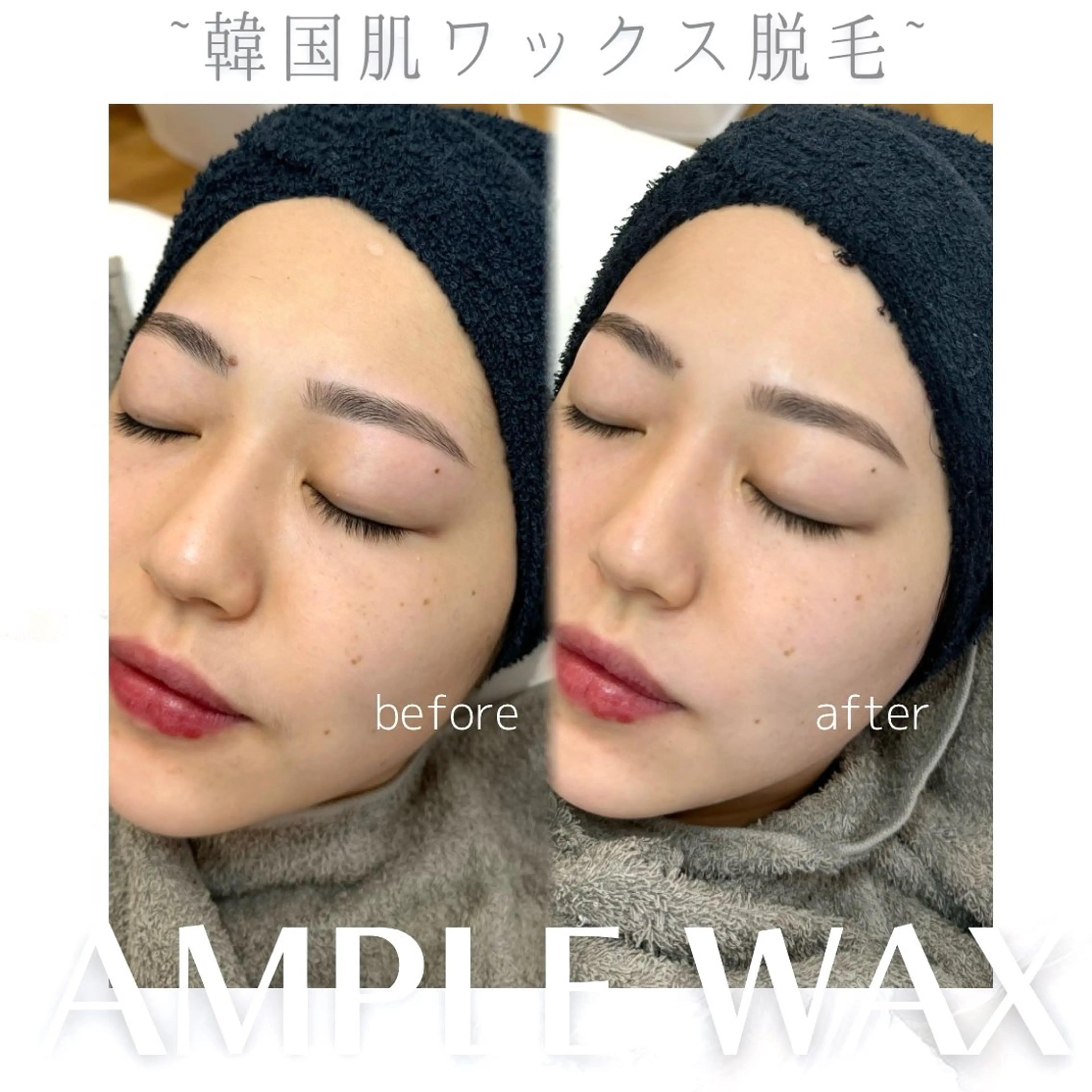 アイブロウ 脱毛 WHITEEYE堺東 店長/藁粥　明の眉毛・アイブロウイメージ