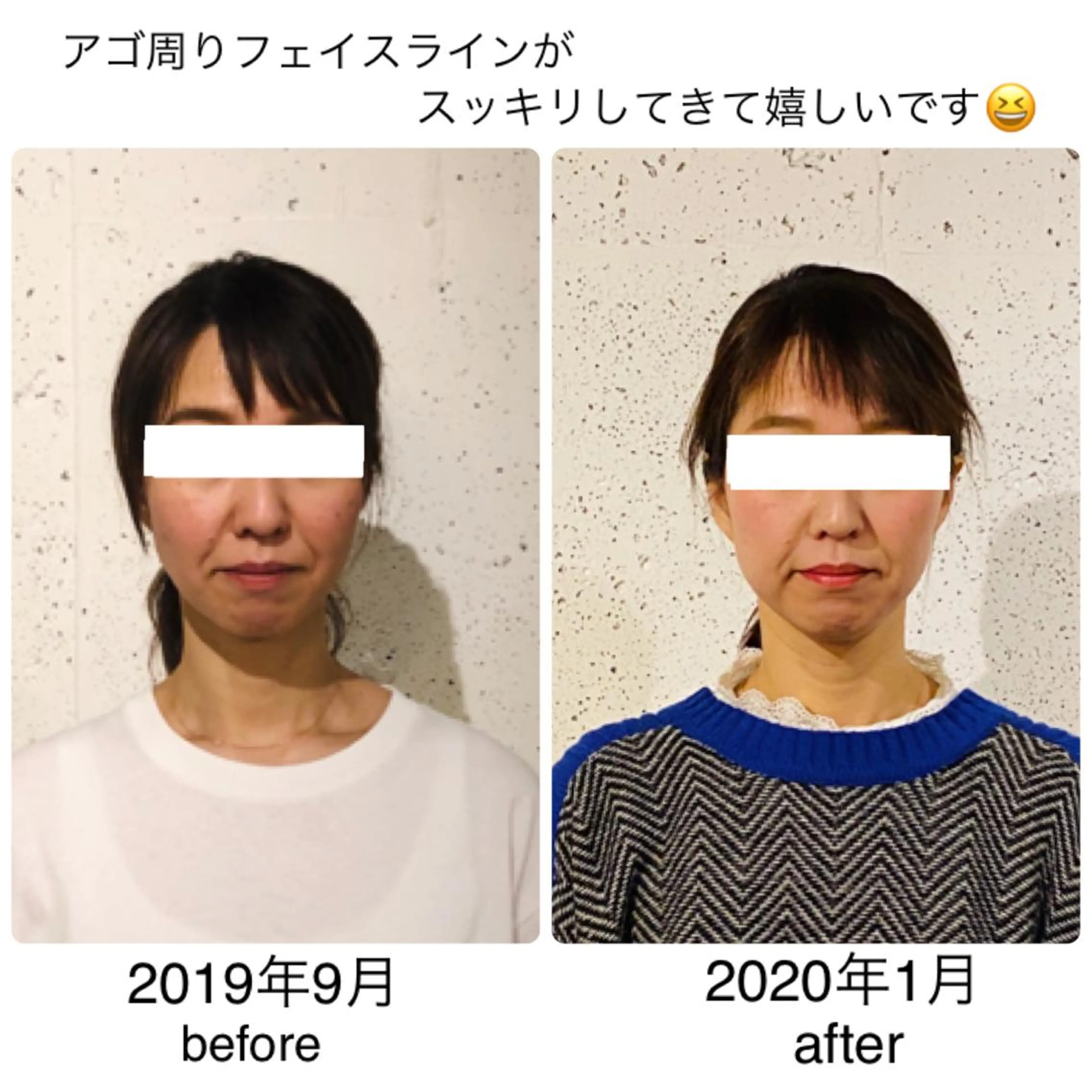 セミロング ネイル マツエク・マツパ 小顔矯正専門サロンジュマリ所属・町田 淳子のエステ・リラクイメージ