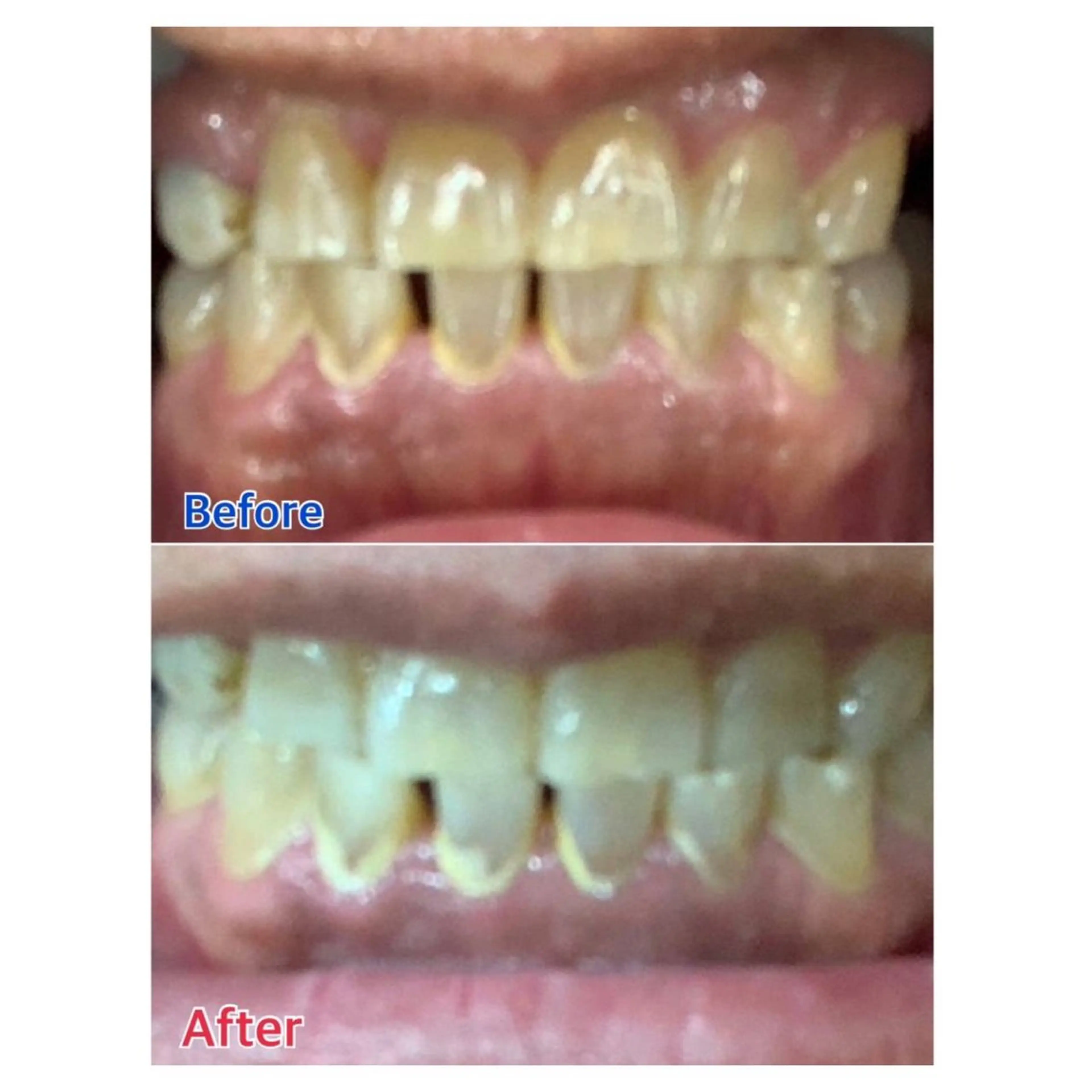 MBEAUTYSALON 千葉店・京成大久保所属・Melty 輝のその他イメージ