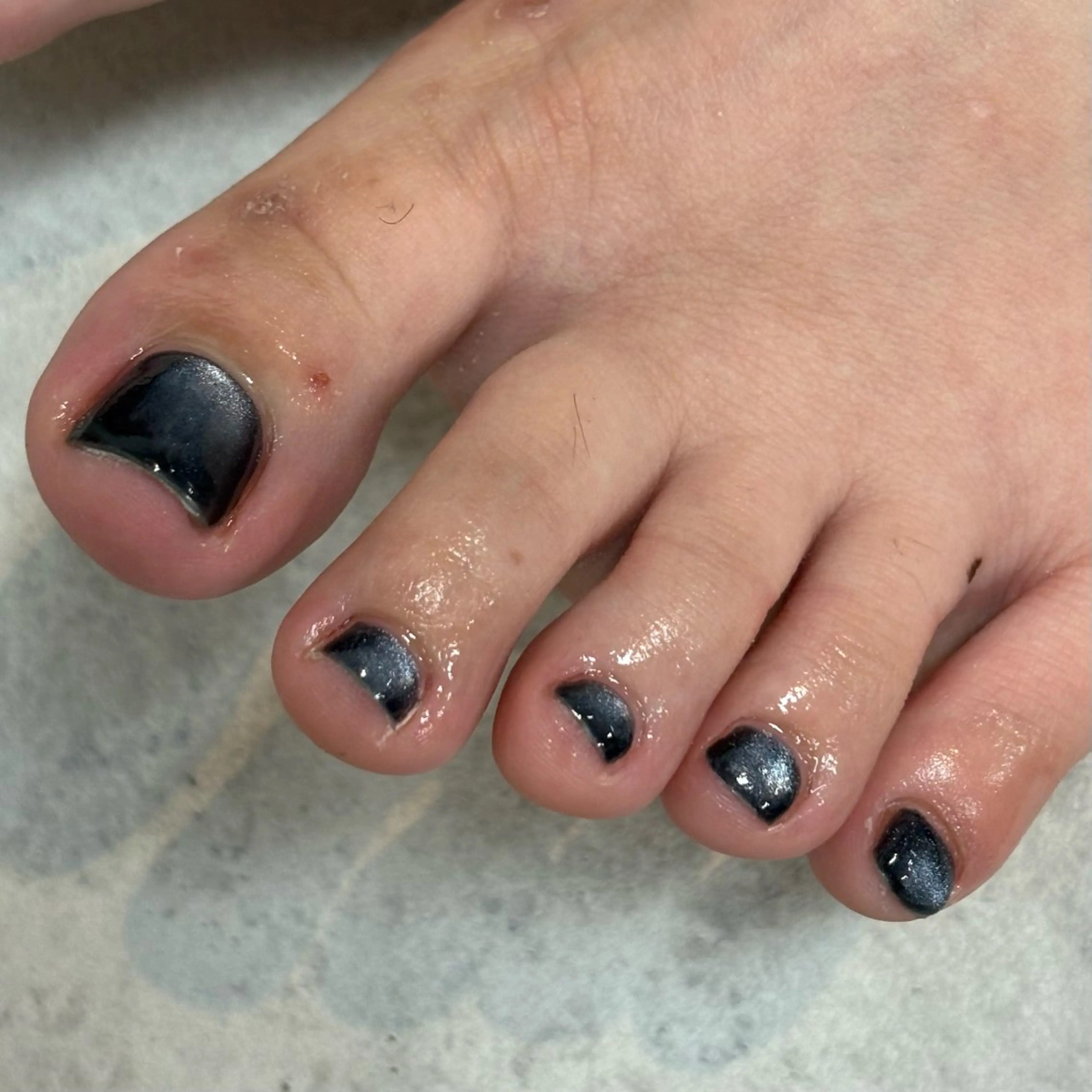 ネイル フットネイル GLADnail新宿 arisaのネイルデザイン