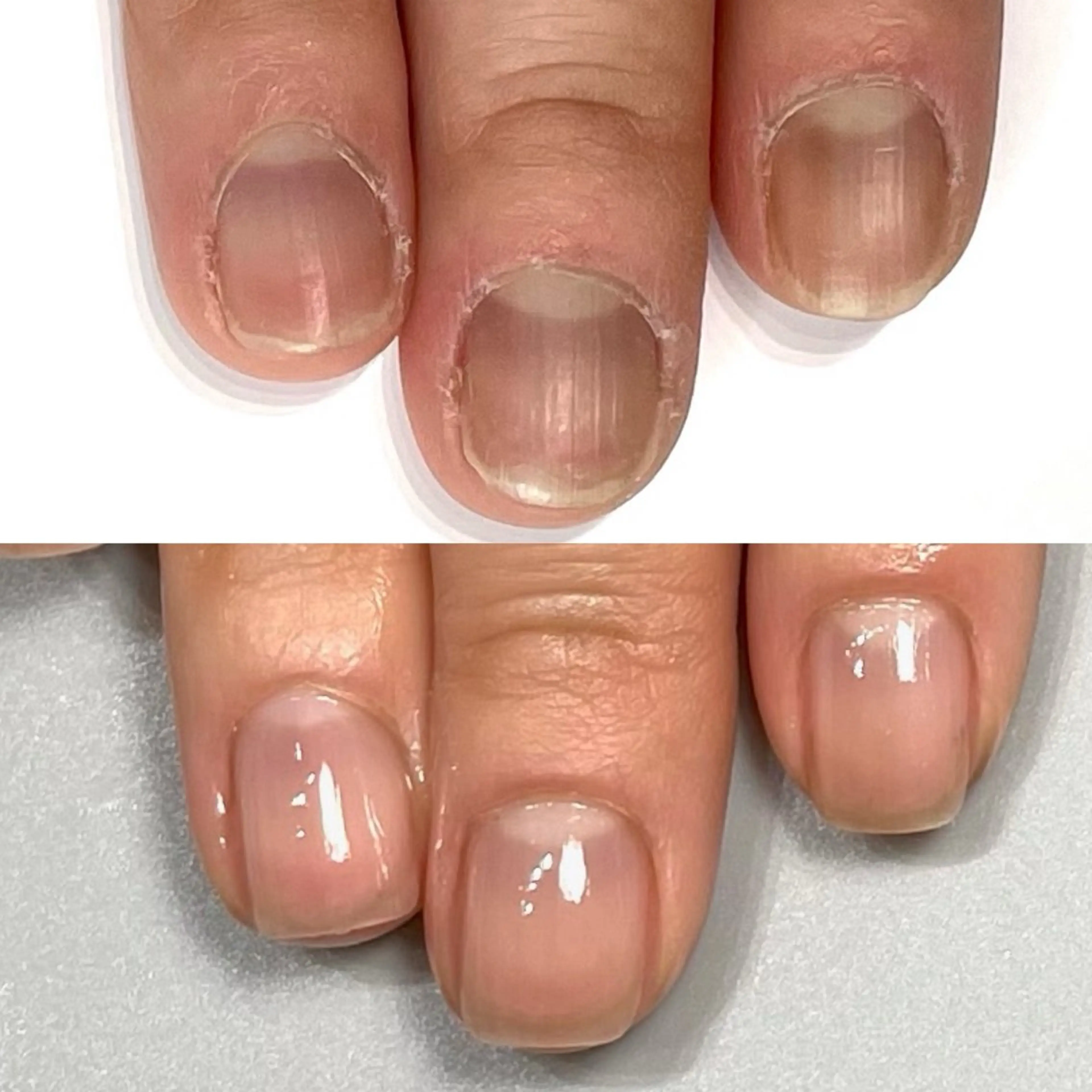 ネイル Aim* 深爪・自爪育成専門店のネイルデザイン