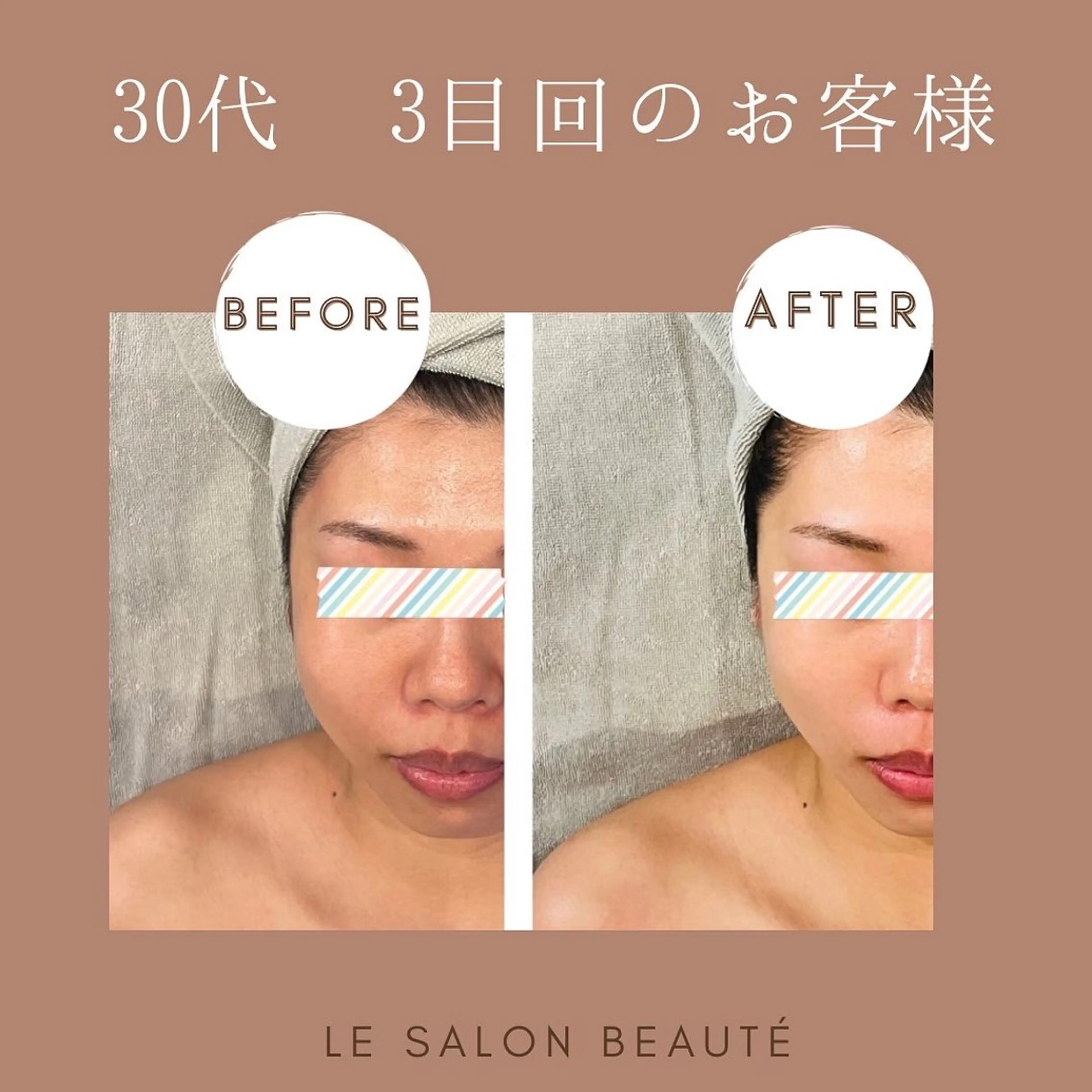 ◆ヒト幹細胞リフトアップ＋小顔マッサージ◆デコルテ→首ケア→ドライヘッド付き！首肩コリ、眼精疲労の方へもおすすめです！の写真