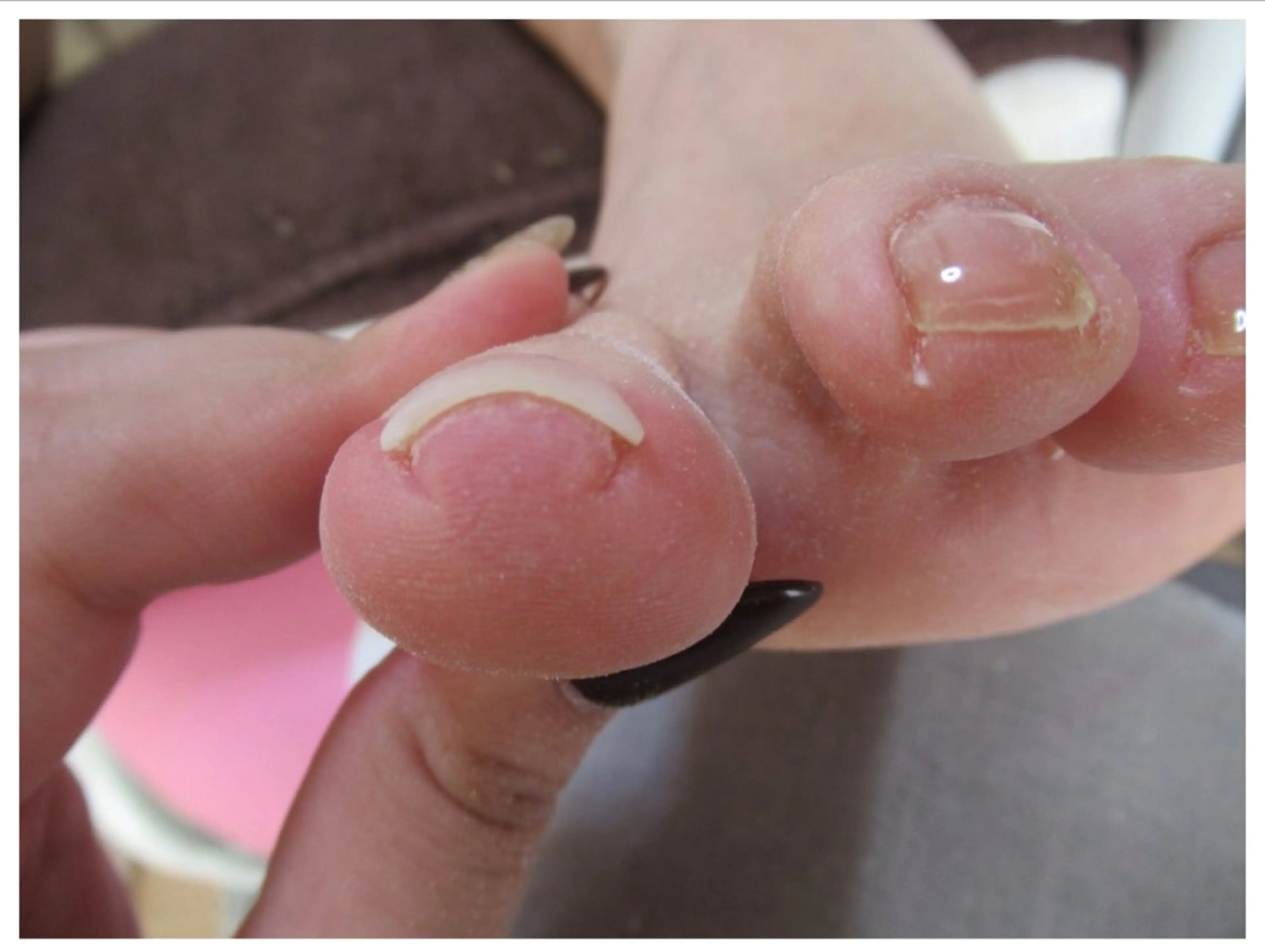 ネイル ネイルサロンailes所属・ネイルサロンエール 店長沼尻のネイルデザイン