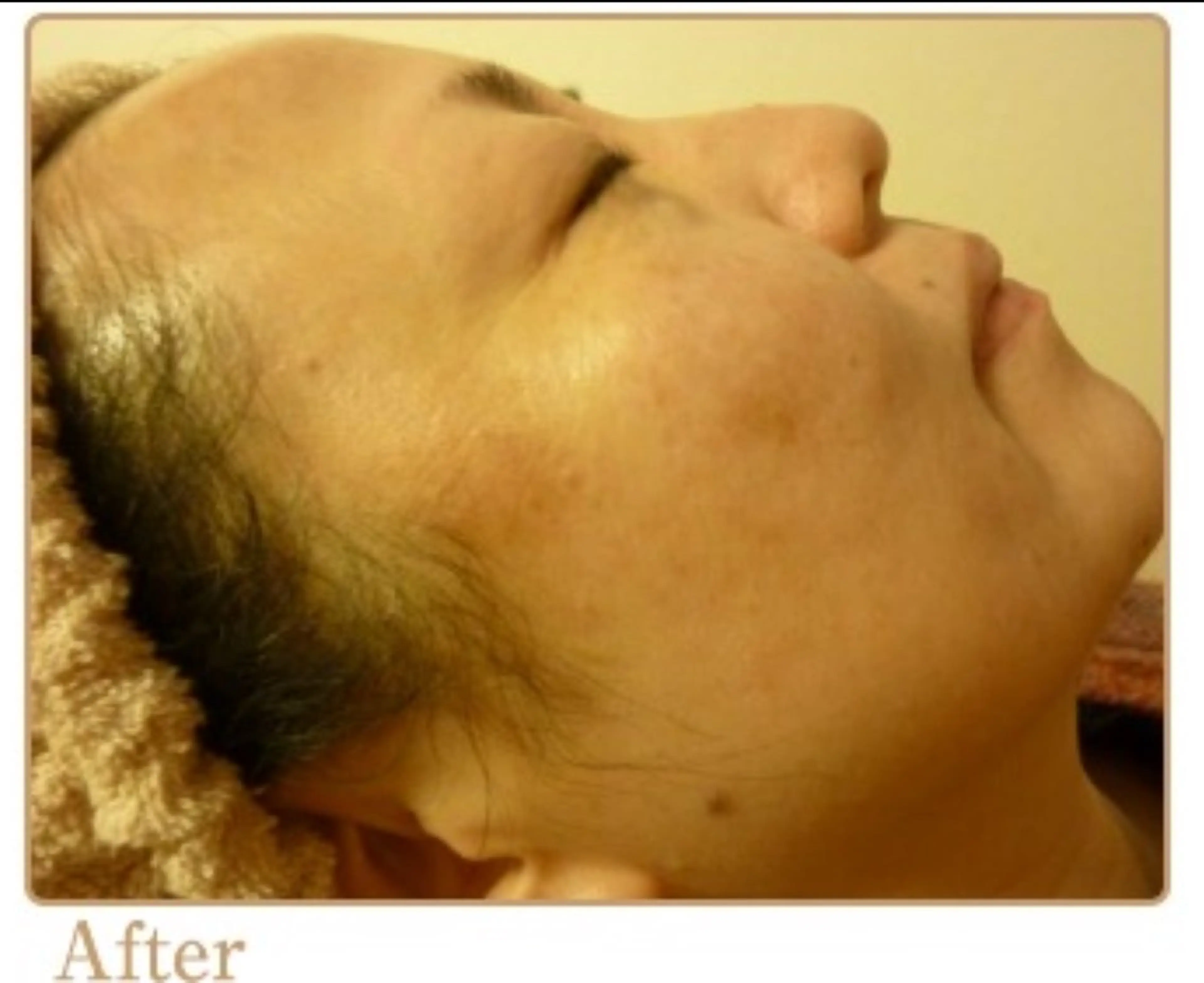 ピーリングサロン シャンテール所属・ピーリングサロン シャンテールのエステ・リラクイメージ