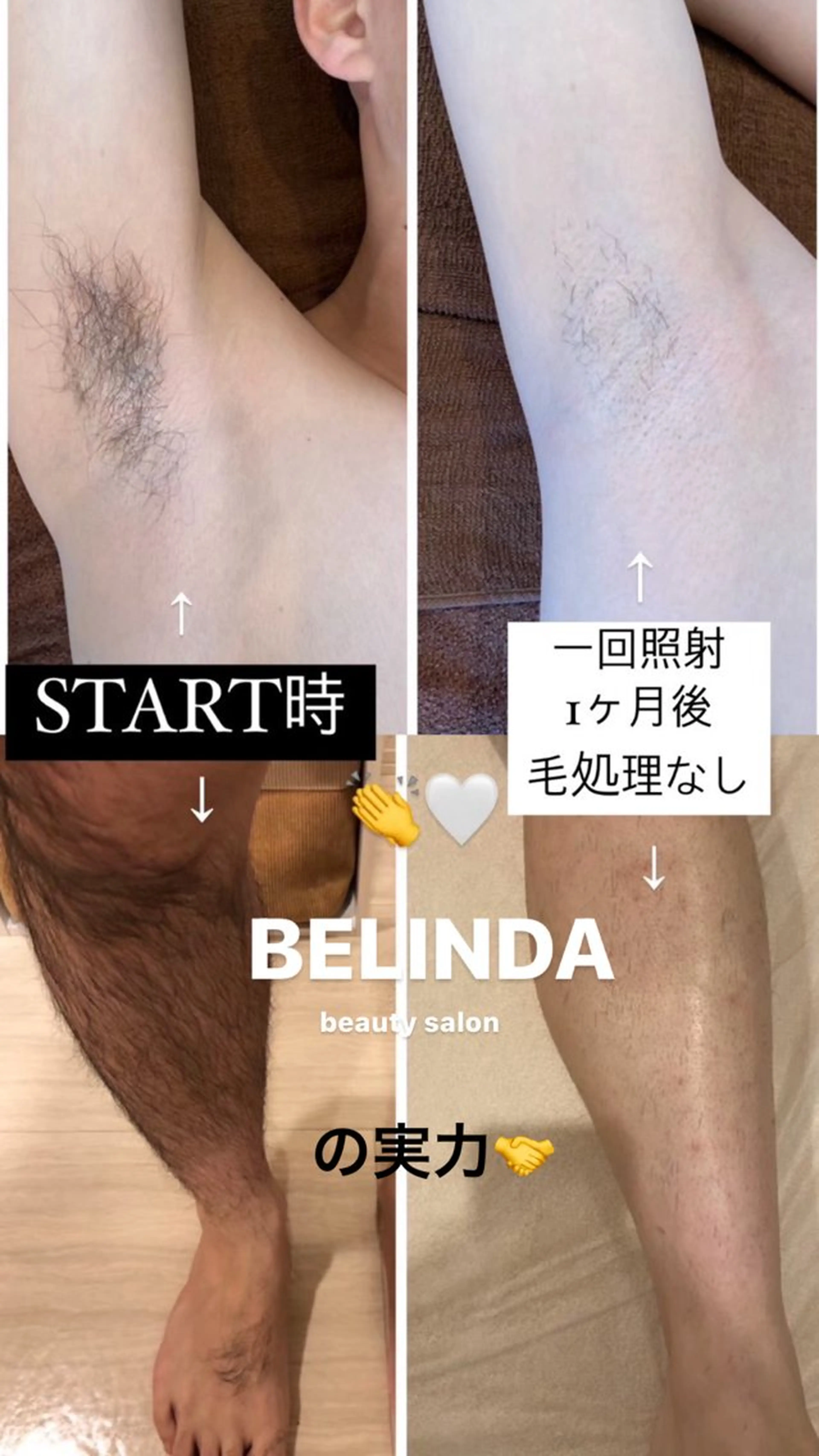 脱毛 BELINDA所属・平 紫音のマツエク・マツパデザイン
