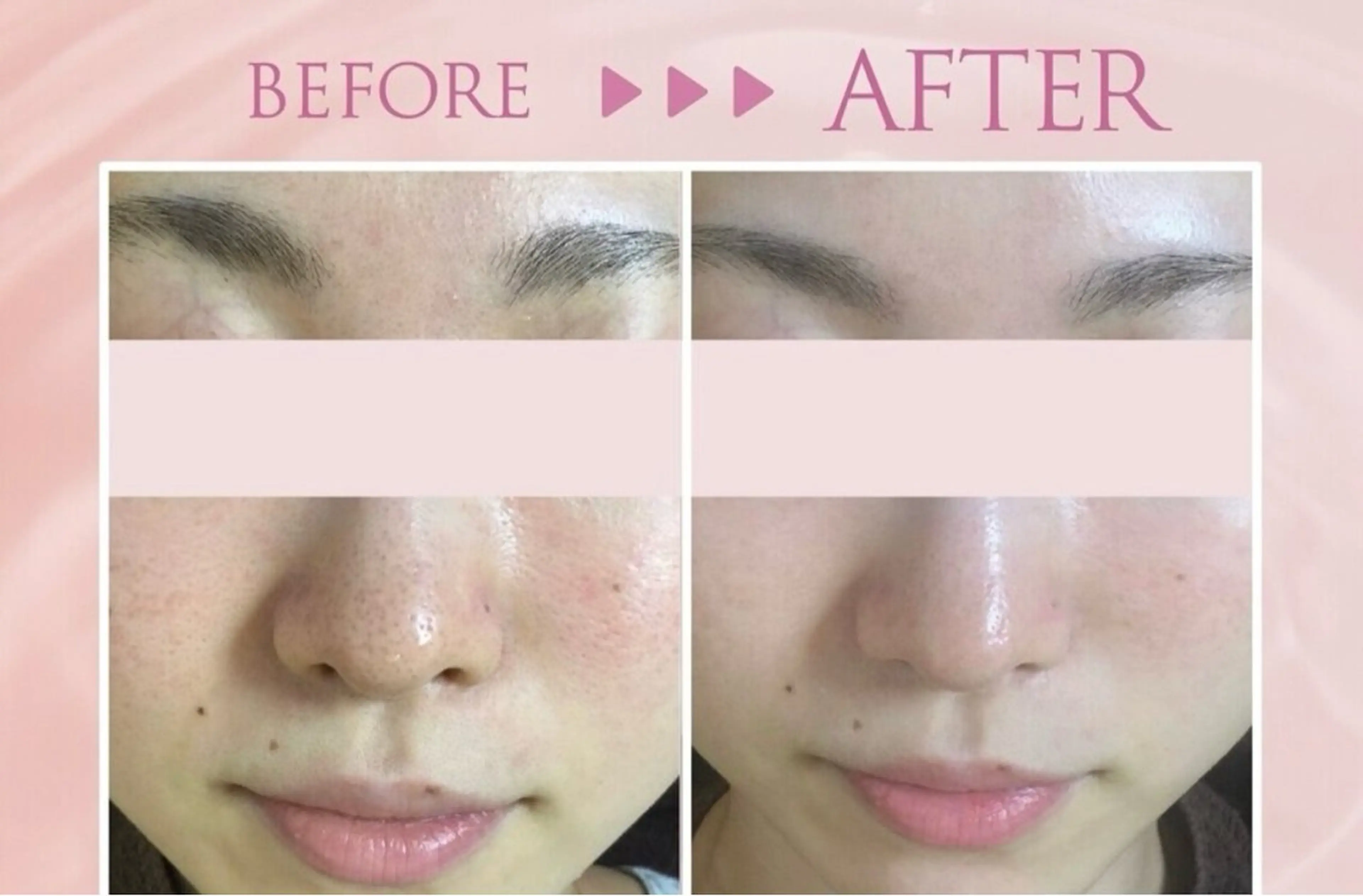 韓国肌管理専門店 Clear Lab 池袋所属・韓国肌管理専門店 池袋店REIKAのエステ・リラクイメージ