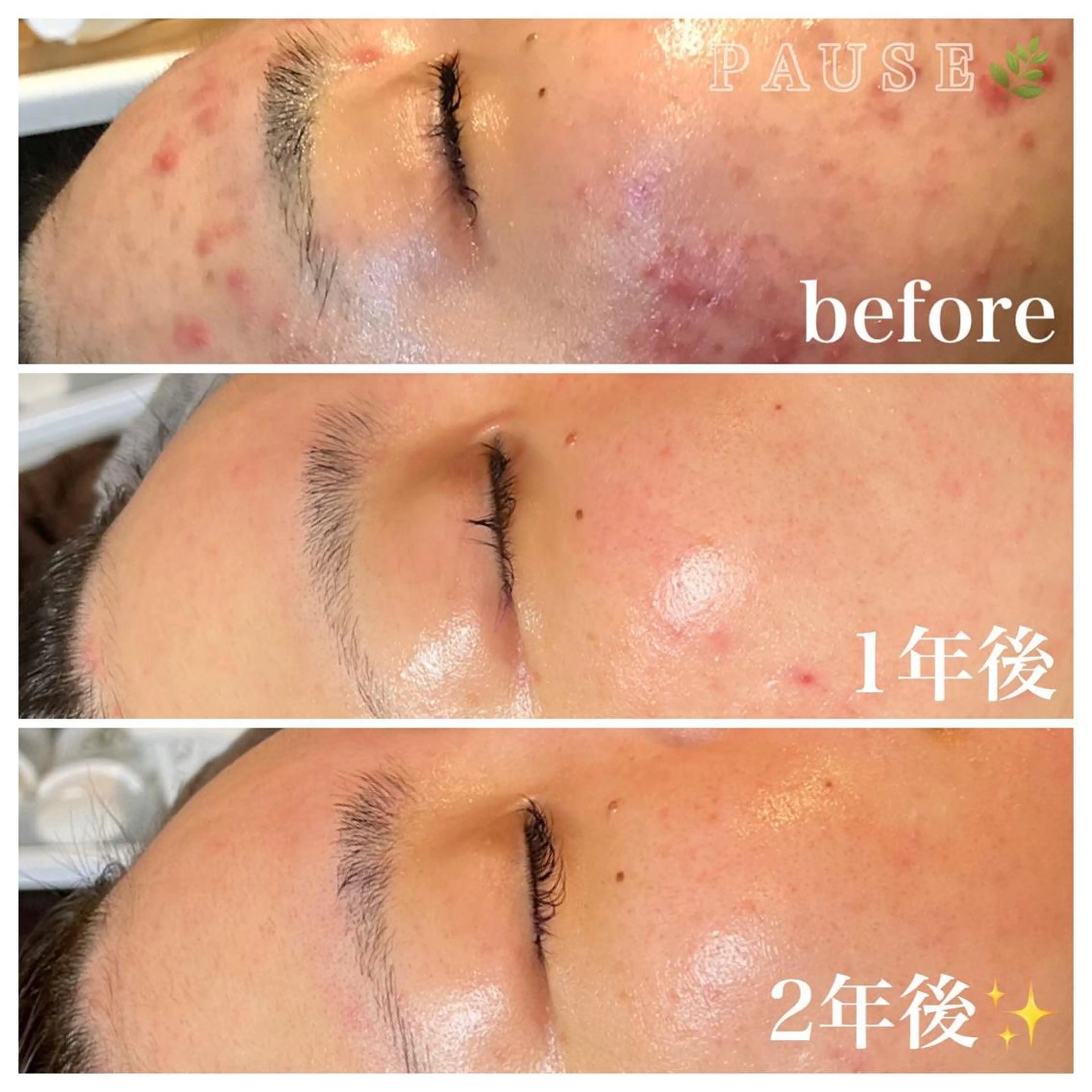 エステ 浜野 恵美のエステ・リラクイメージ