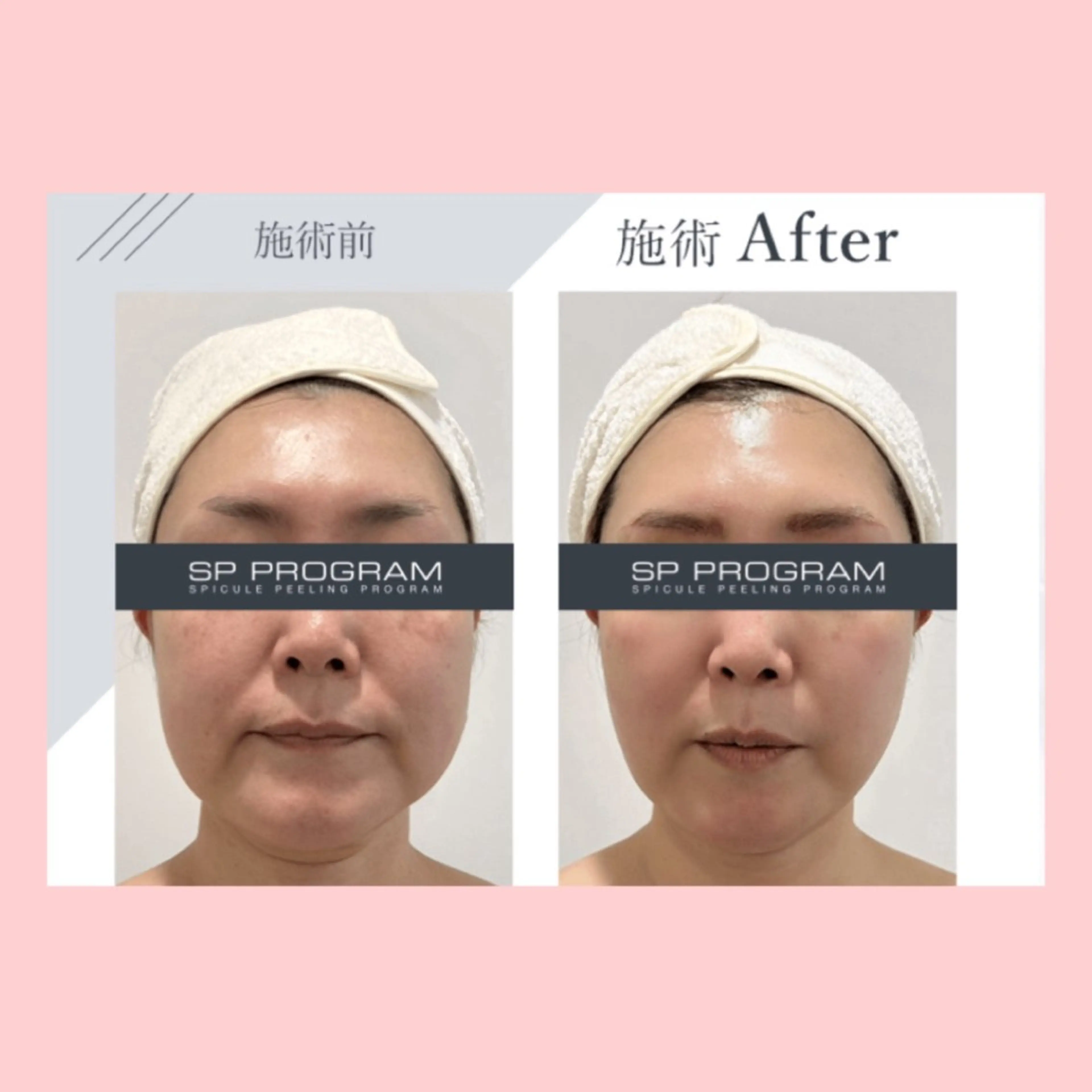 その他 Palum Airiのエステ・リラクイメージ