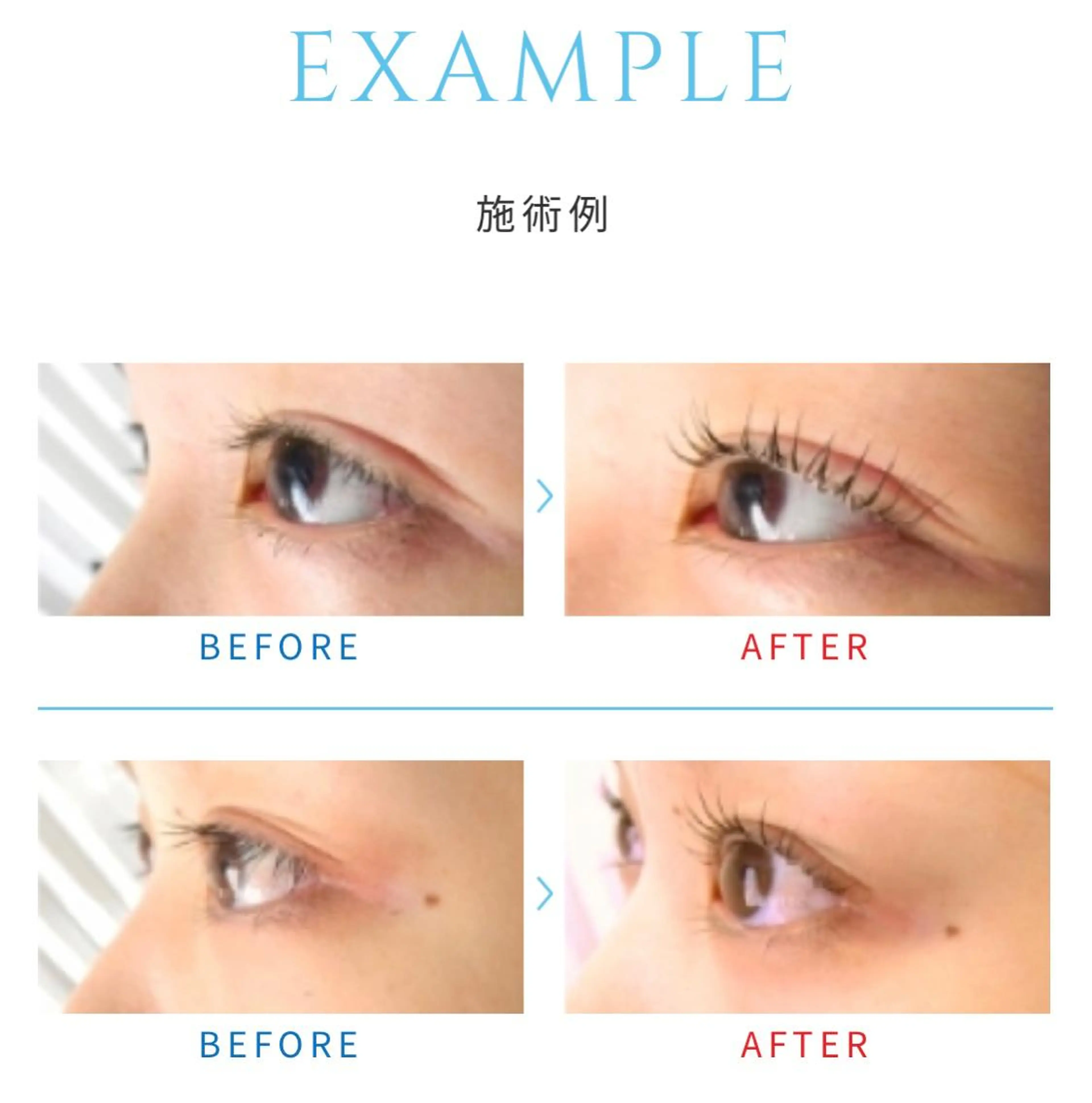 マツエク・マツパ BONITO所属・TOYOOKA ERUMOのエステ・リラクイメージ