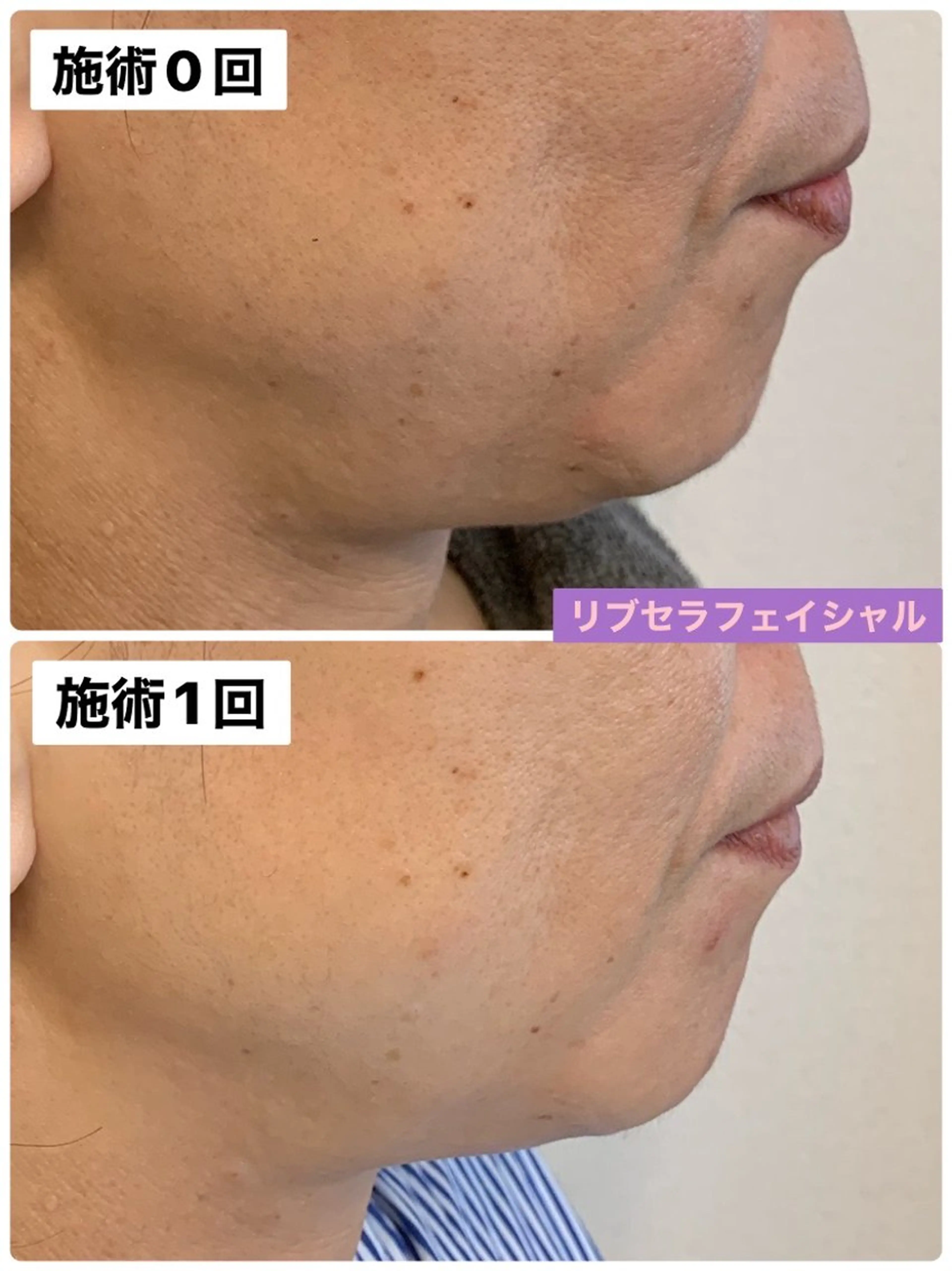 エステ Private Salon Prunelle所属・プライベートサロン プリュネルのエステ・リラクイメージ