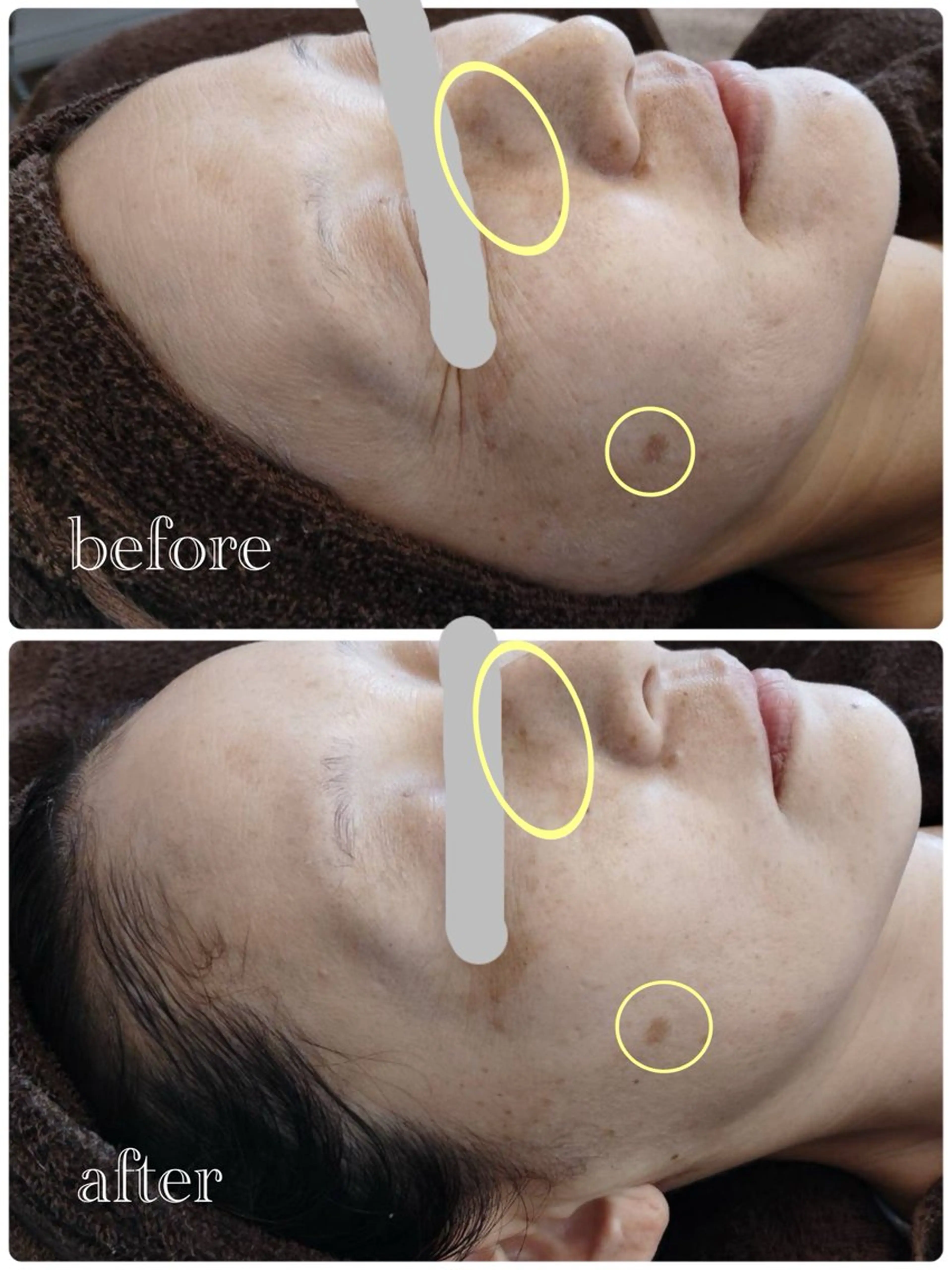 エステ cesalon Pono所属・cesalon Ponoのエステ・リラクイメージ