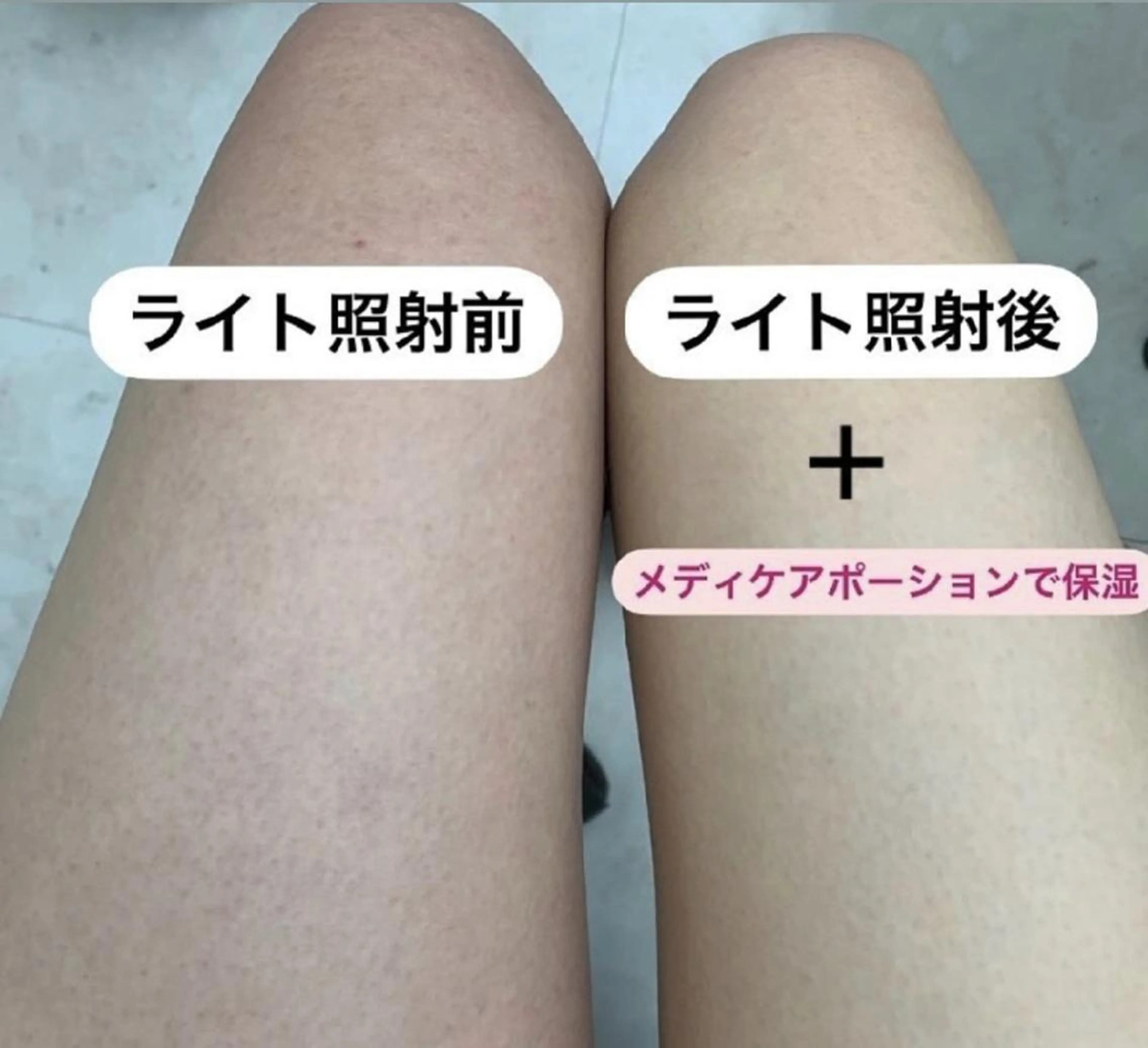 脱毛都度払い専門nagomi金沢店所属・脱毛都度払い専門 nagomi金沢店のエステ・リラクイメージ