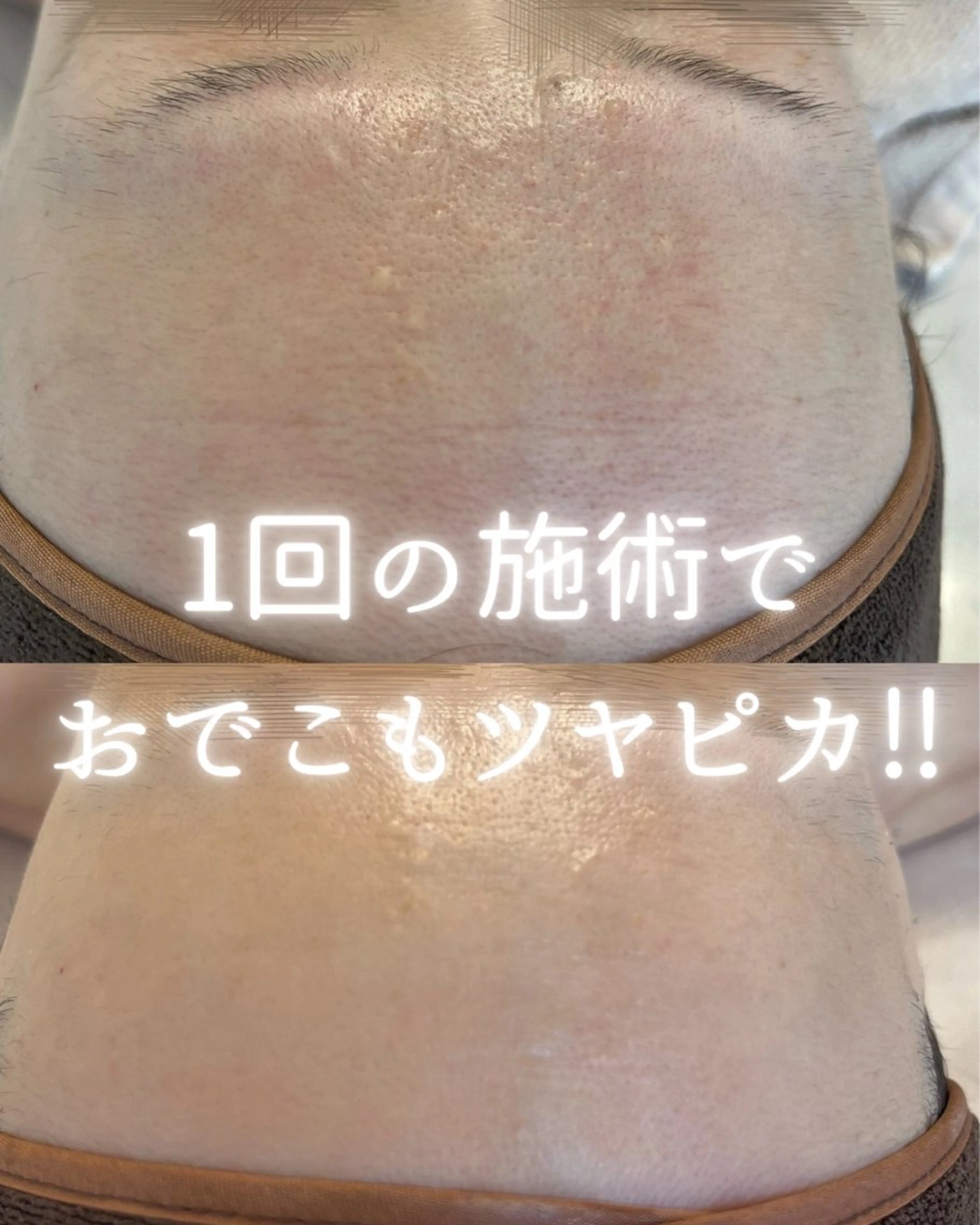 private beauty salon Lilby所属・リルビー 肌育・肌質改善サロンのその他イメージ