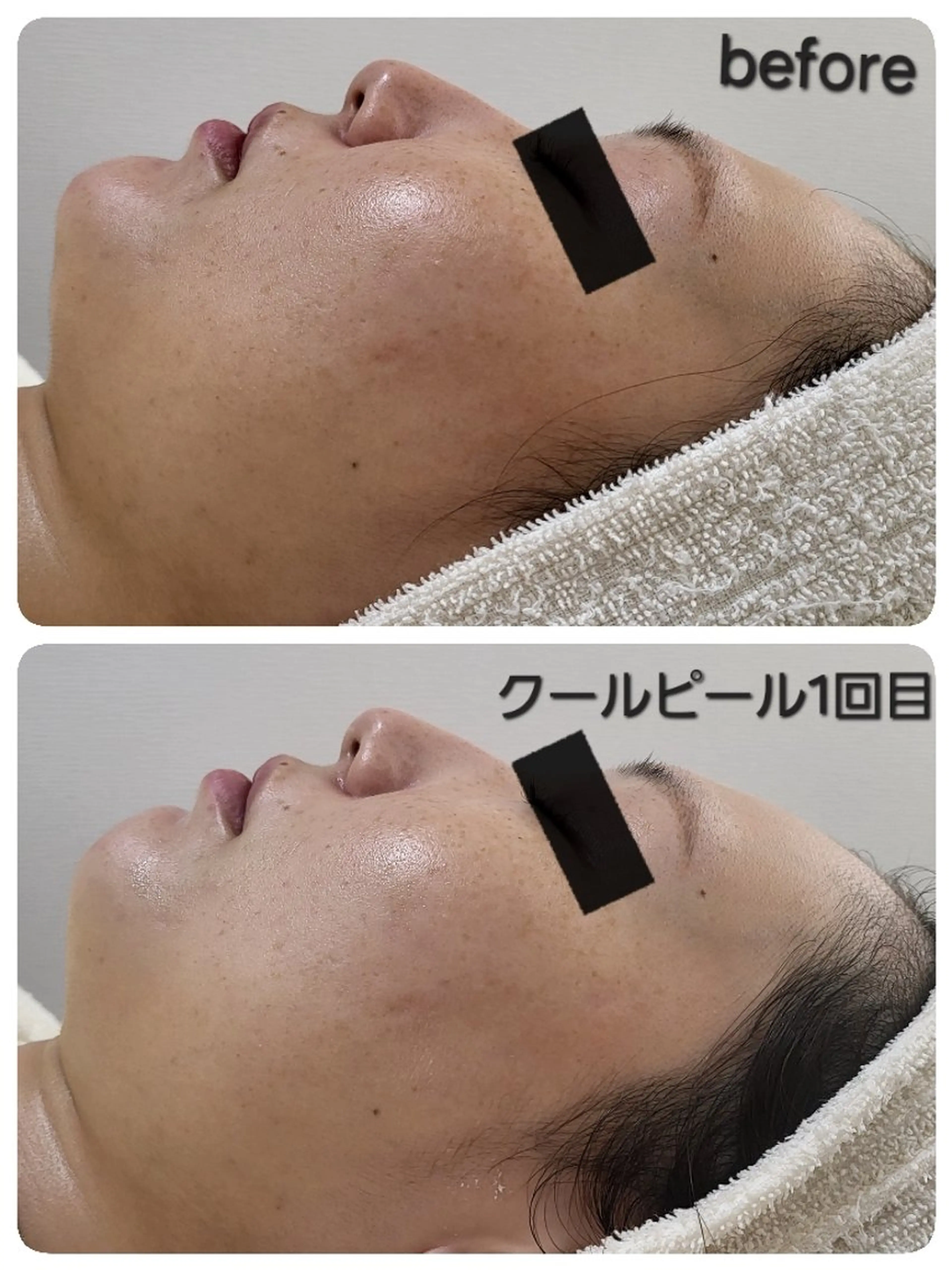 エステ ニキビケア&ニキビ跡 レゾン京橋店 のエステ・リラクイメージ