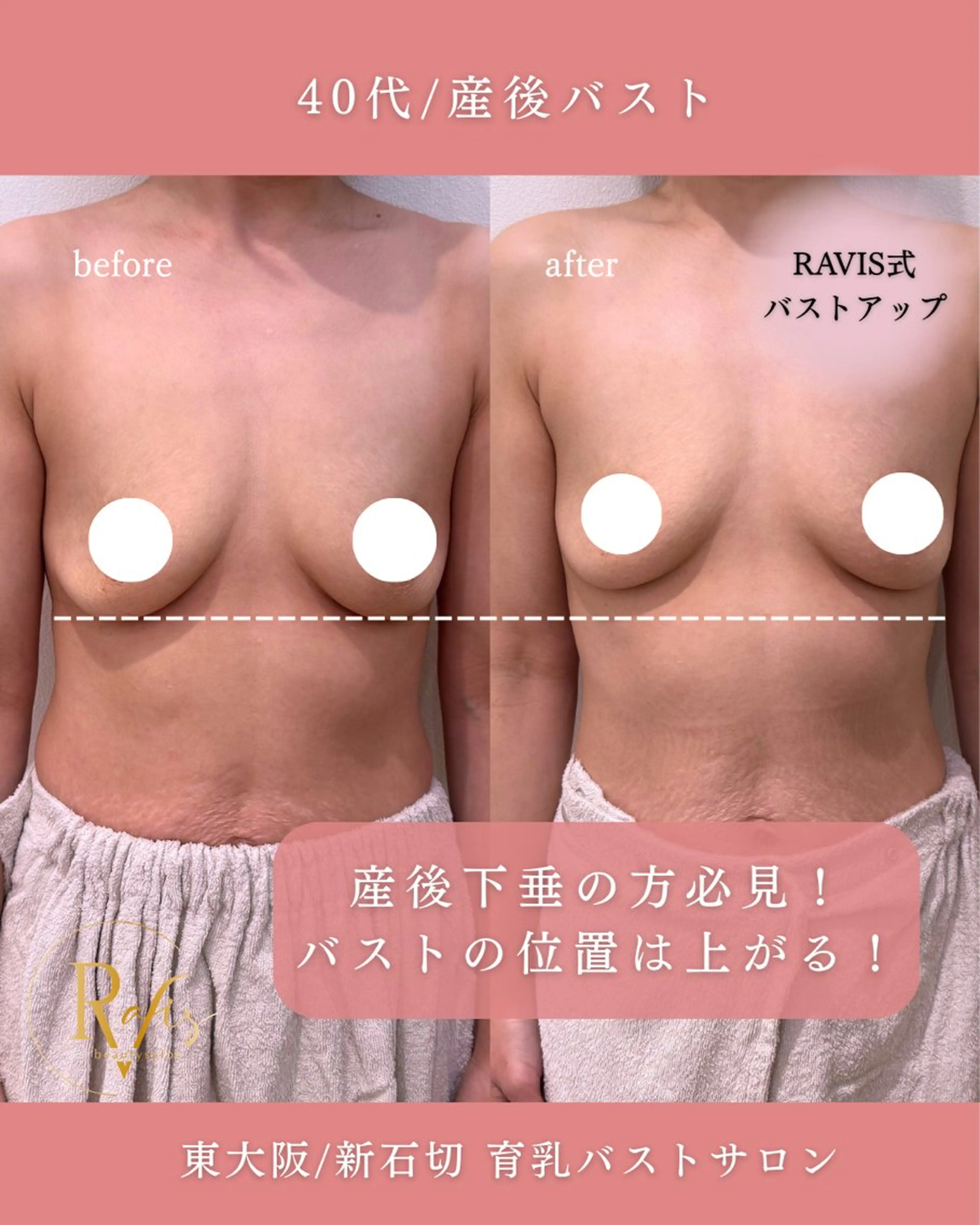 エステ beautysalon RAVIS所属・東大阪/韓国肌管理/ 痩身バスト専門店のエステ・リラクイメージ