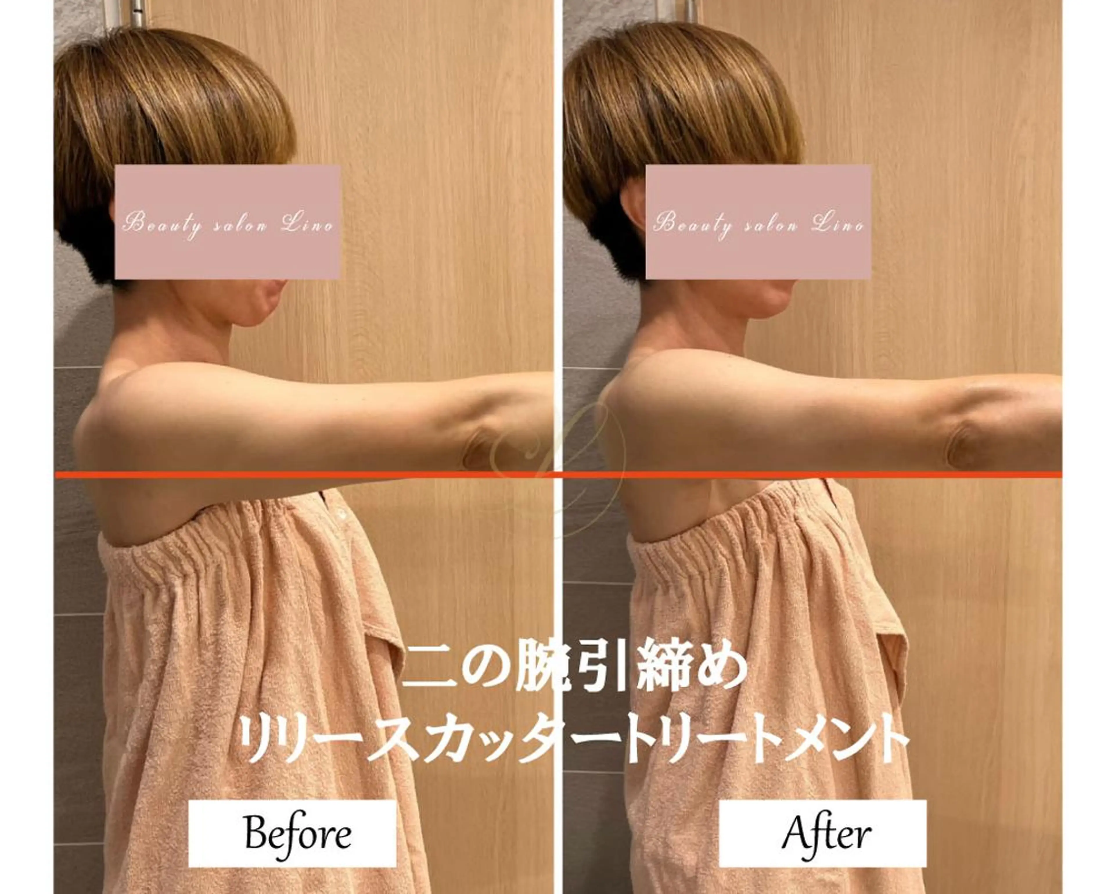 エステ リラク 肩こり改善 筋膜リリースカッターのエステ・リラクイメージ