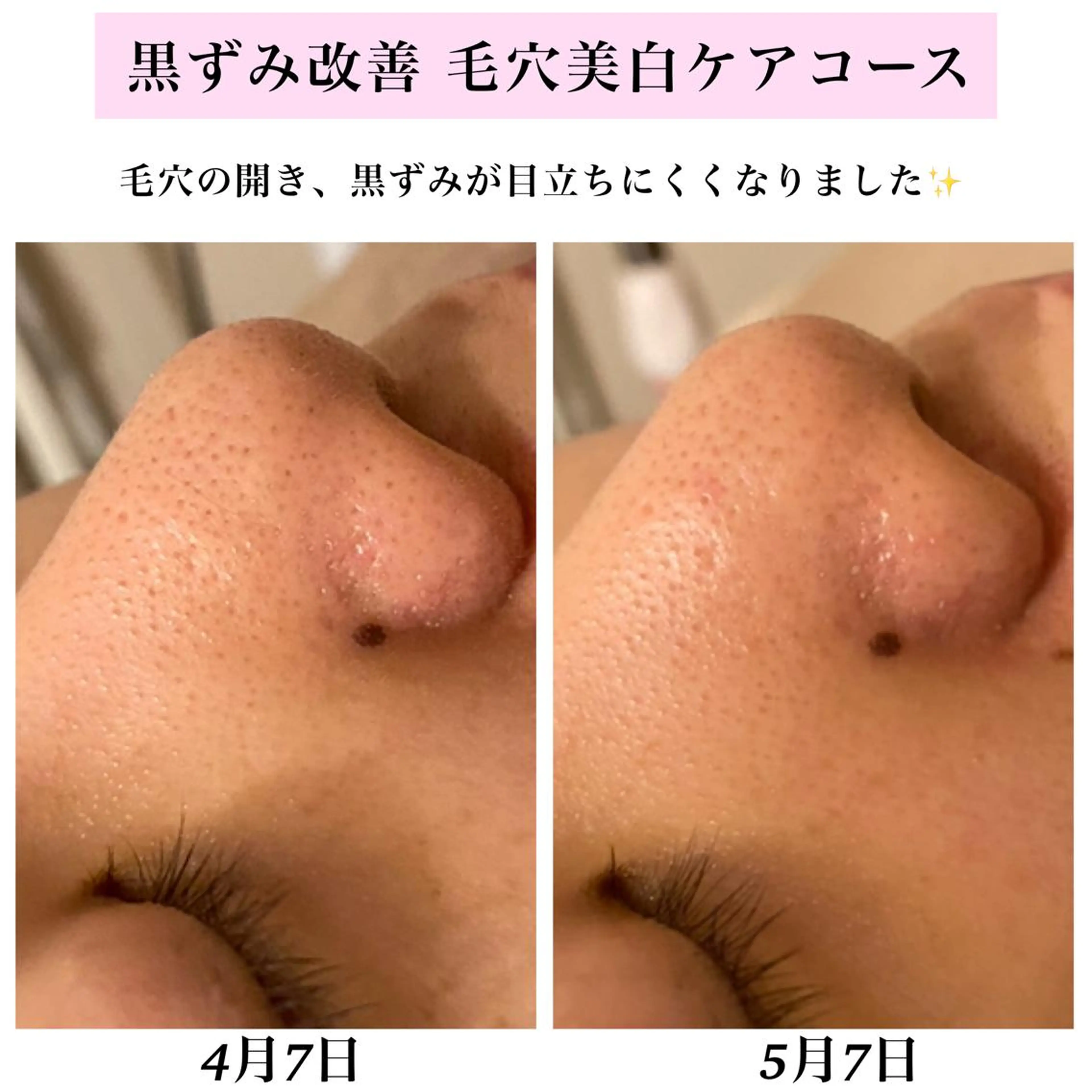 エステ リラク Bellesthe （ベルエステ）のエステ・リラクイメージ